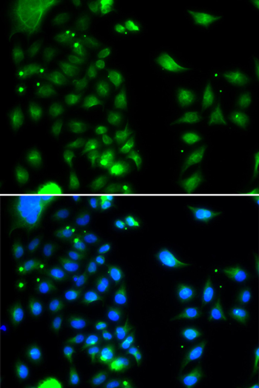 Immunofluorescence analysis of MCF-7 cells using UBE2J2 Polyclonal Antibody