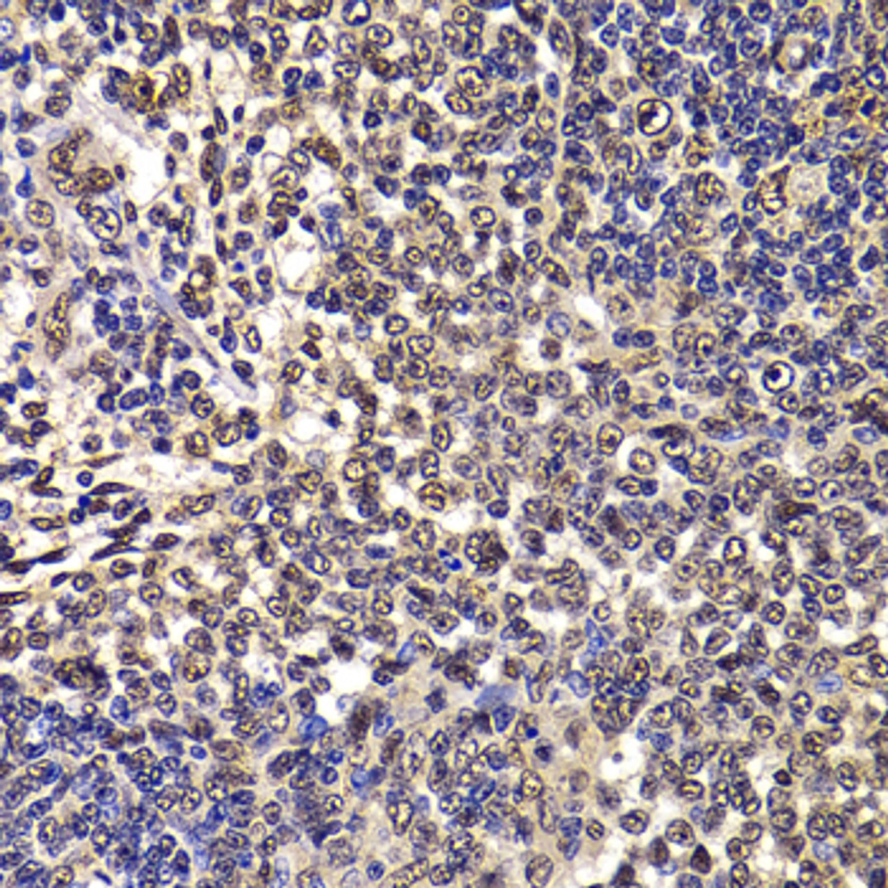 Immunohistochemistry of paraffin-embedded Rat spleen using WBSCR22 Polyclonal Antibody at dilution of  1:100 (40x lens).