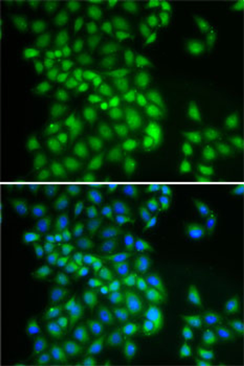 Immunofluorescence analysis of A-549 cells using YTHDC1 Polyclonal Antibody