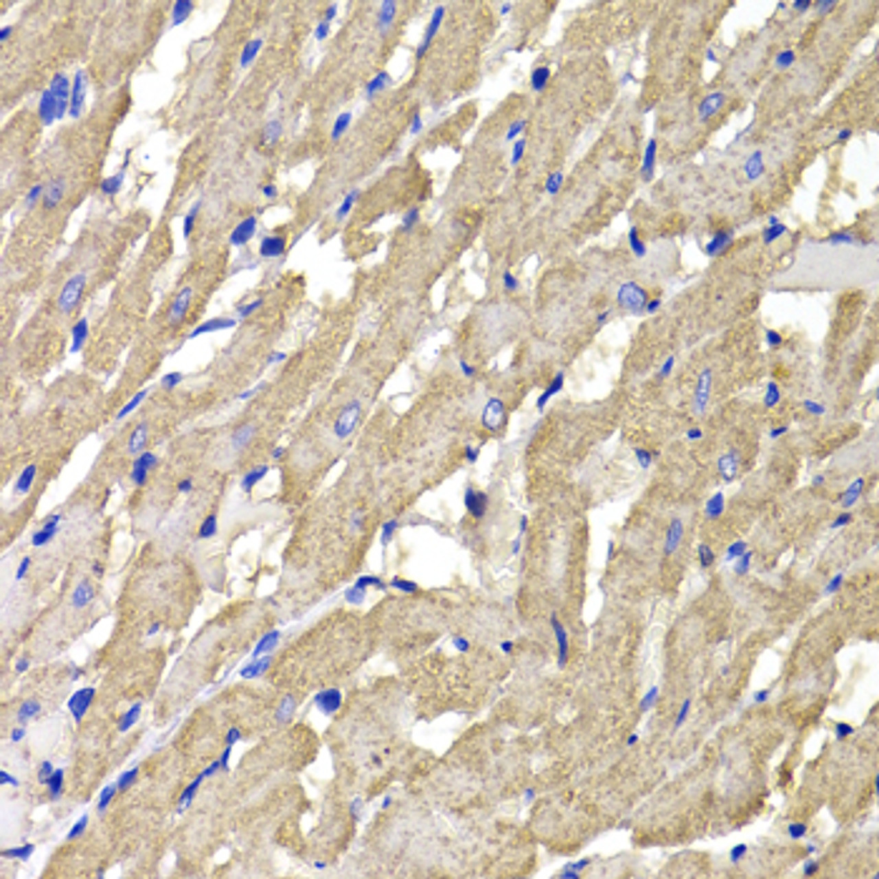 Immunohistochemistry of paraffin-embedded Rat heart using MPI Polyclonal Antibody at dilution of  1:100 (40x lens).