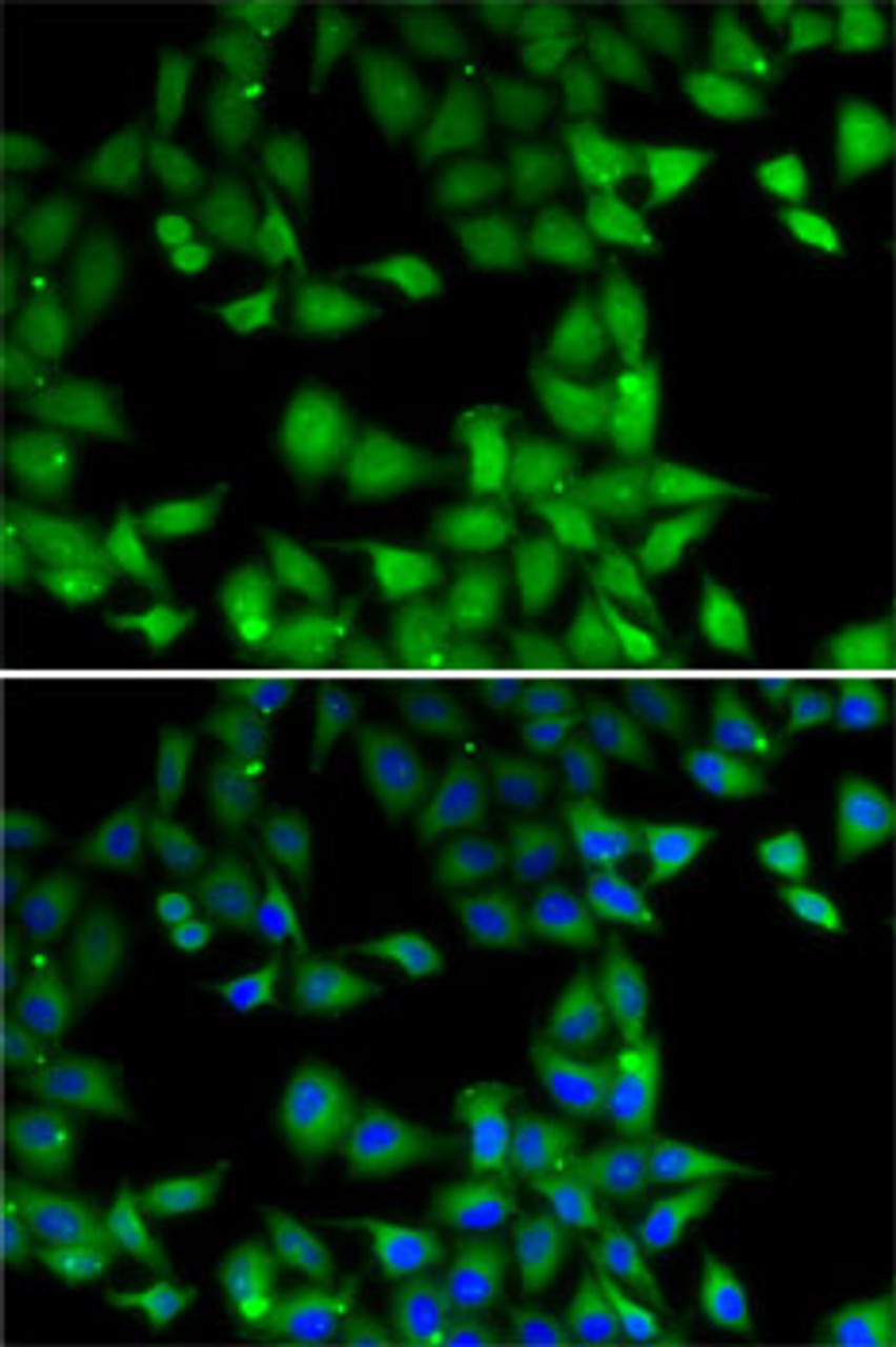 Immunofluorescence analysis of MCF7 cells using MPI Polyclonal Antibody