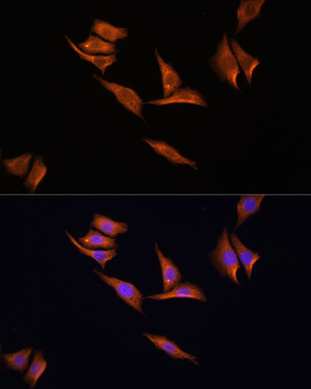 Immunofluorescence analysis of HeLa cells using AMPKα2 Polyclonal Antibody at dilution of  1:100 (40x lens). Blue: DAPI for nuclear staining.