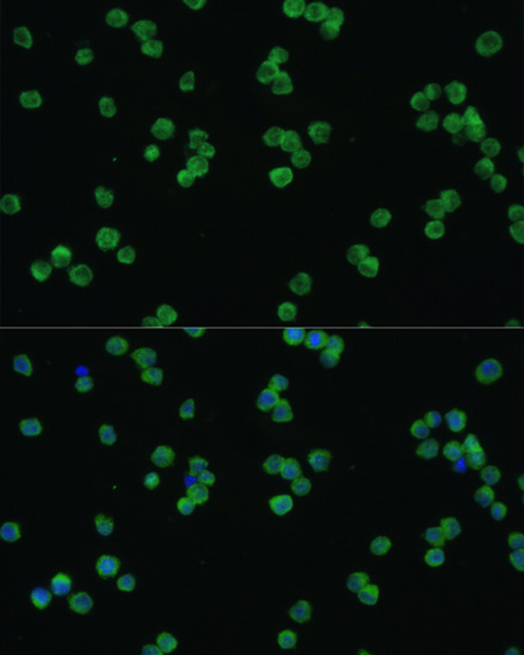 Immunofluorescence analysis of Raw264.7 cells using LZTR1 Polyclonal Antibody at dilution of  1:100. Blue: DAPI for nuclear staining.