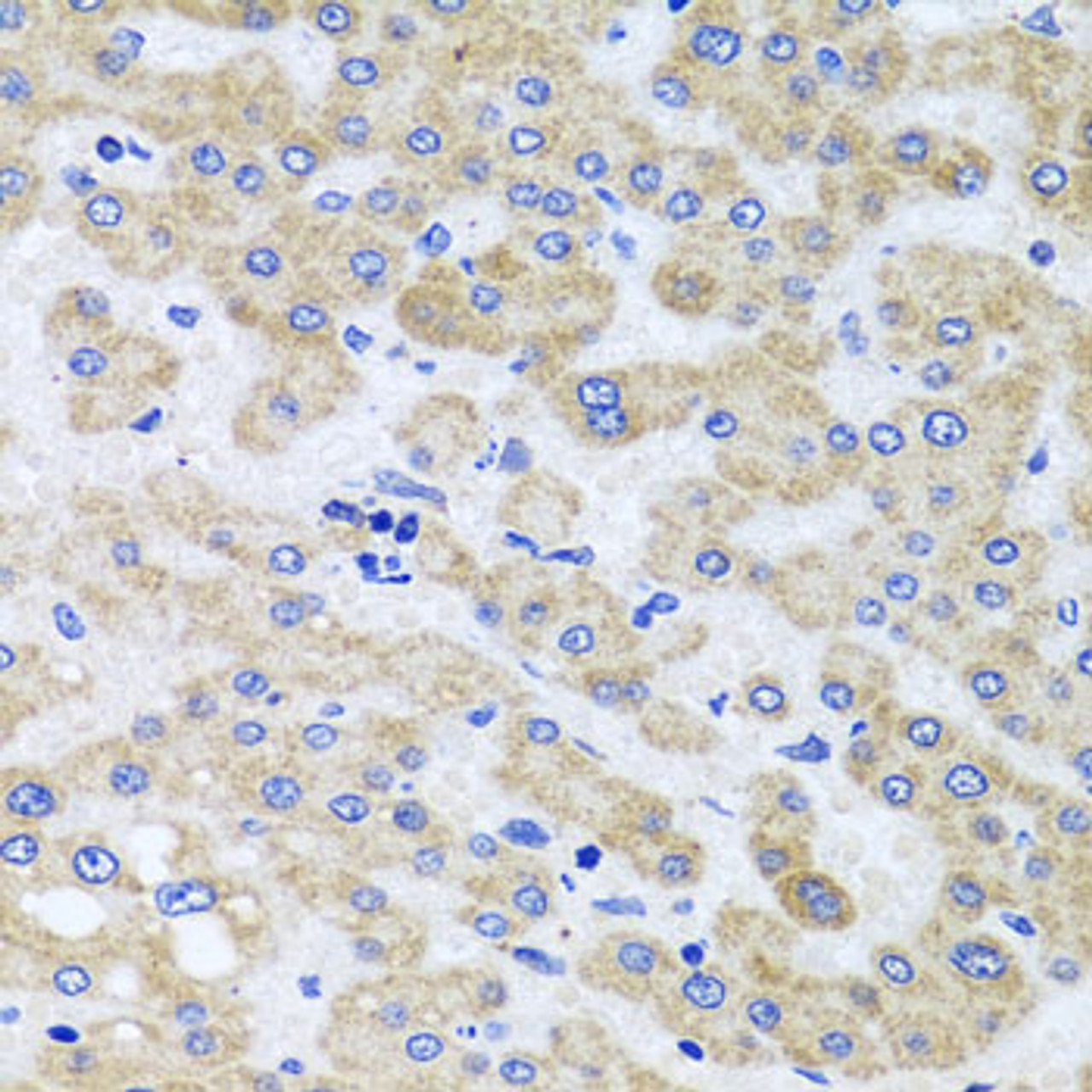Immunohistochemistry of paraffin-embedded Human liver damage using PEX3 Polyclonal Antibody at dilution of  1:100 (40x lens).