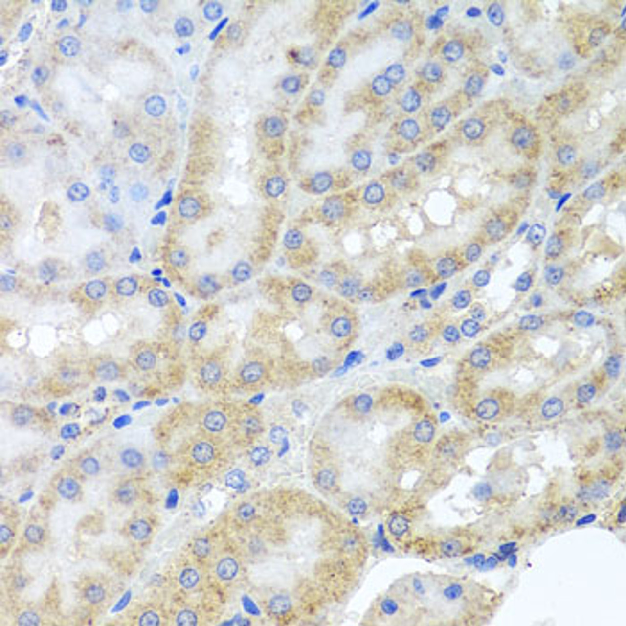 Immunohistochemistry of paraffin-embedded Rat kidney using PEX3 Polyclonal Antibody at dilution of  1:100 (40x lens).