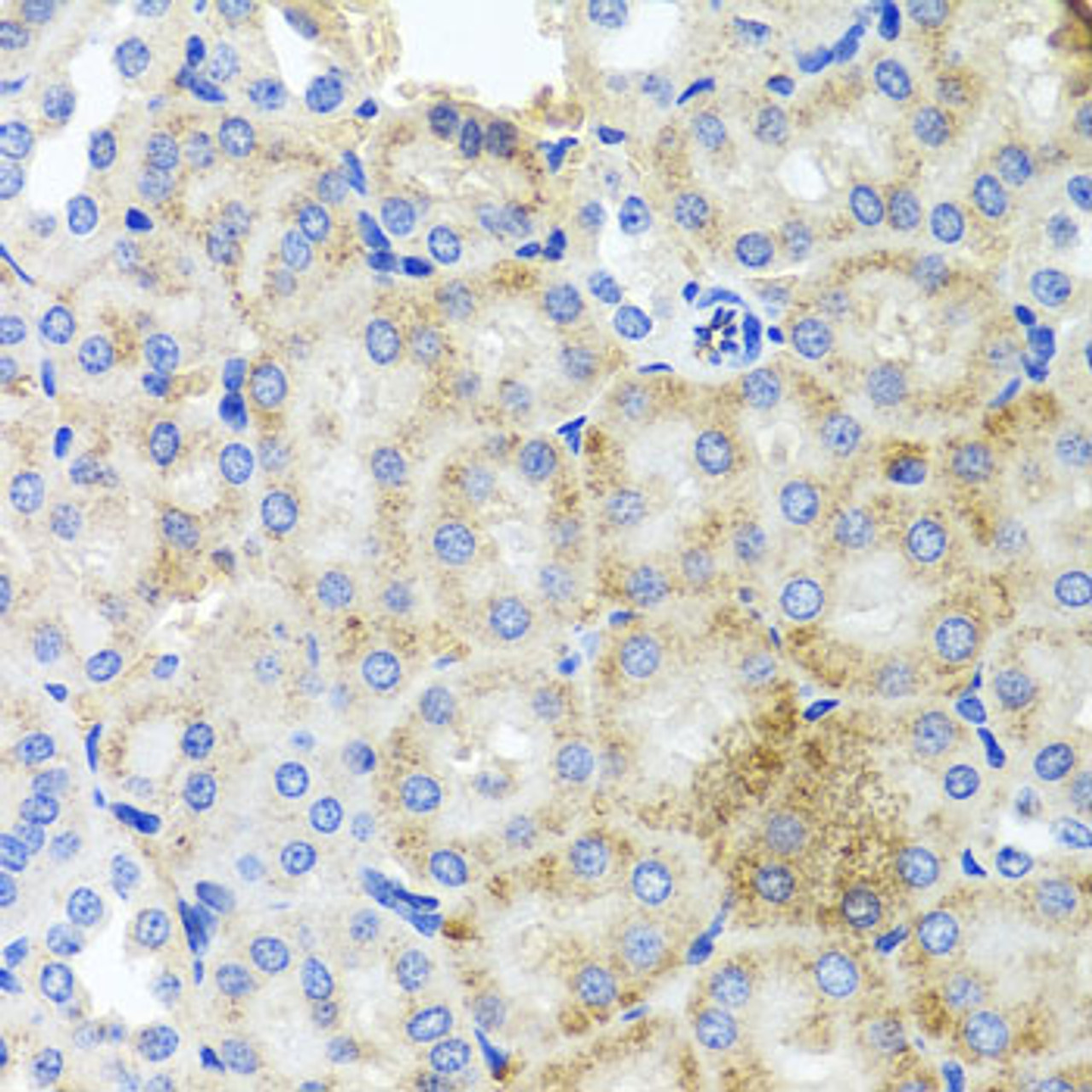 Immunohistochemistry of paraffin-embedded Mouse kidney using PEX3 Polyclonal Antibody at dilution of  1:100 (40x lens).