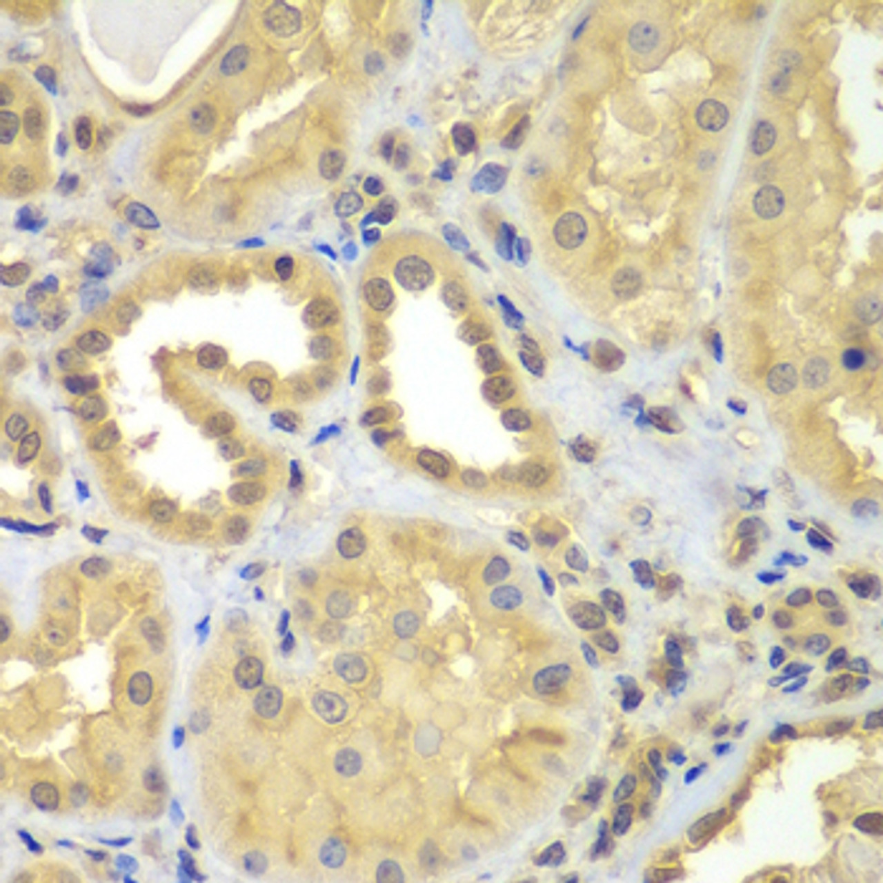 Immunohistochemistry of paraffin-embedded Human kidney using CIAO1 Polyclonal Antibody at dilution of  1:100 (40x lens).