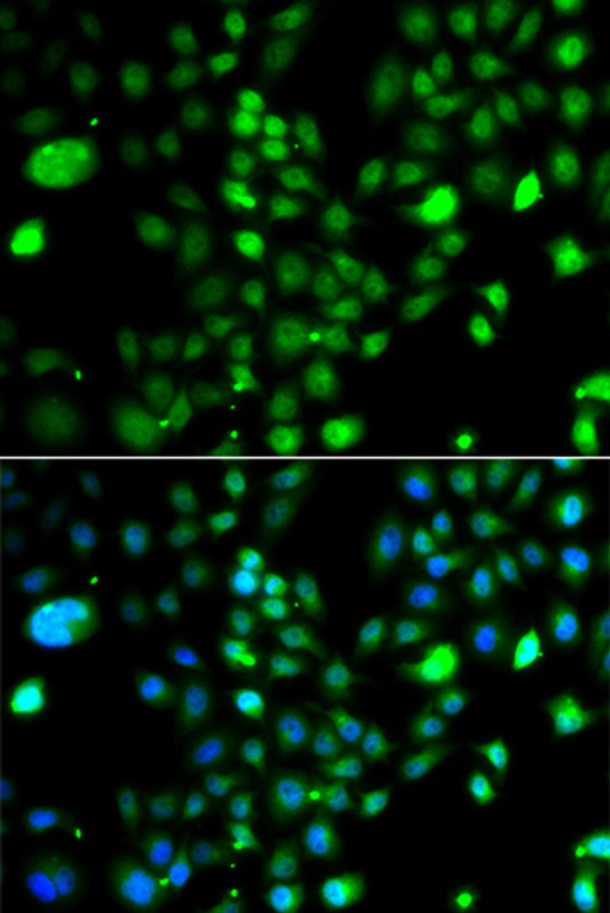 Immunofluorescence analysis of A549 cells using PRDM5 Polyclonal Antibody