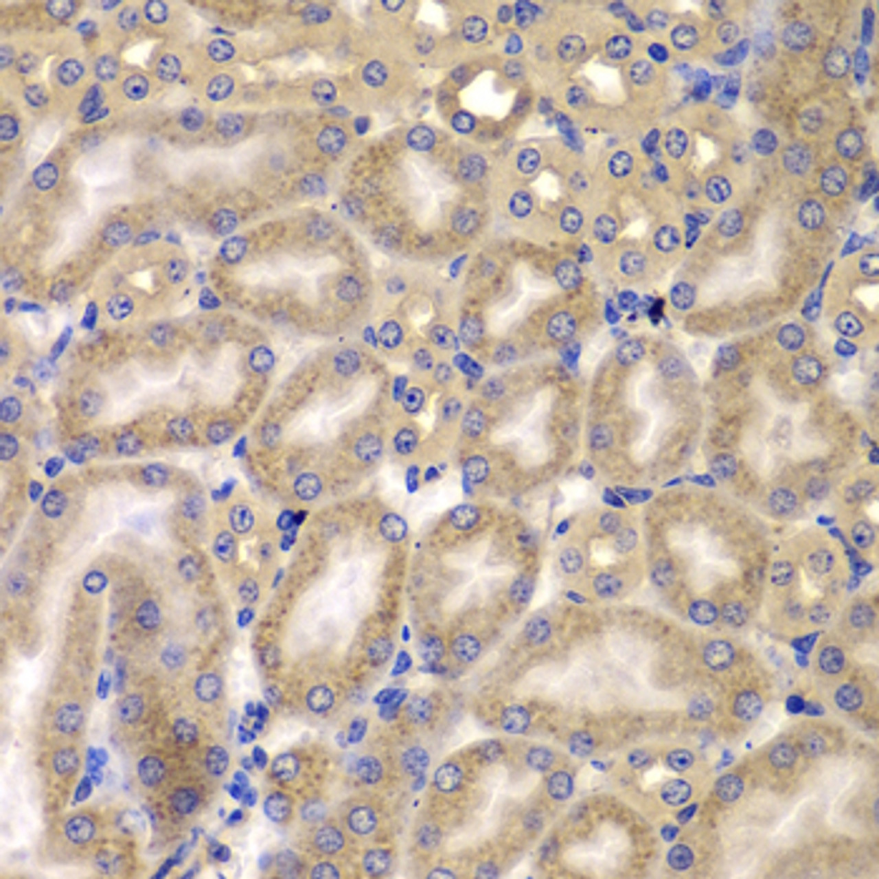 Immunohistochemistry of paraffin-embedded Mouse kidney using CARD10 Polyclonal Antibody at dilution of  1:100 (40x lens).