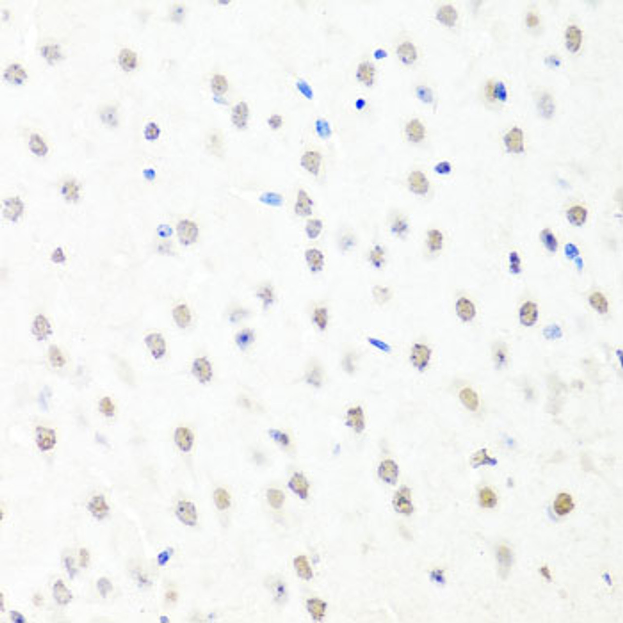 Immunohistochemistry of paraffin-embedded Mouse brain using CHRAC1 Polyclonal Antibody at dilution of  1:100 (40x lens).