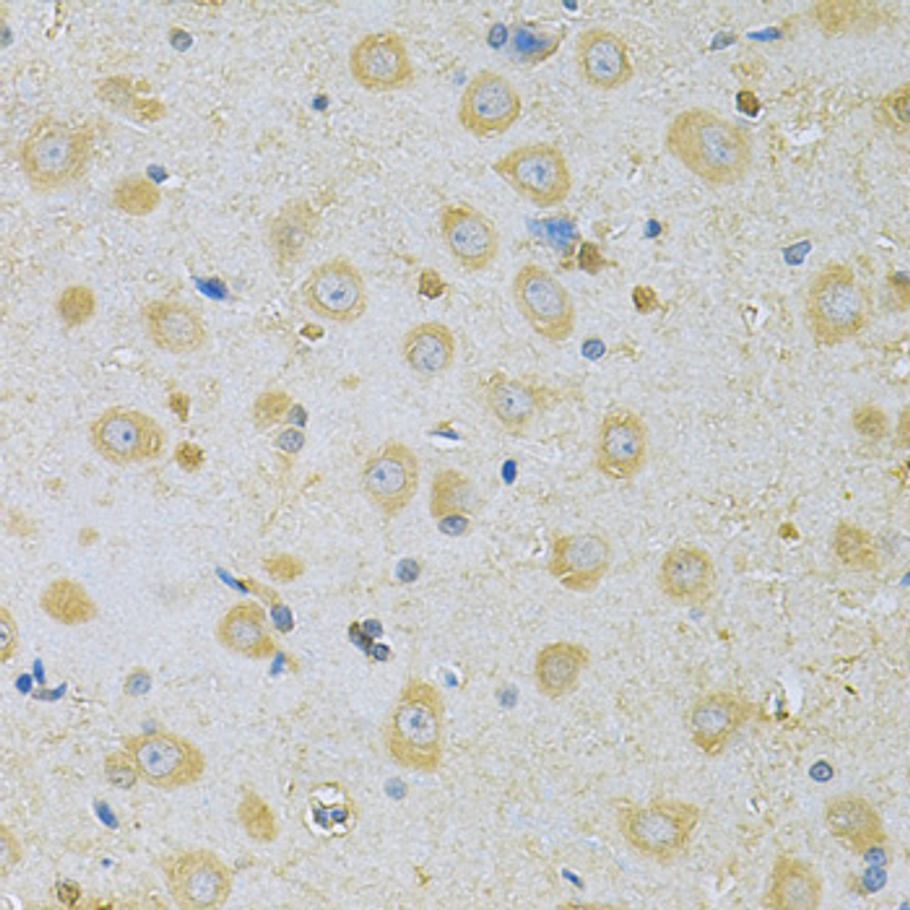 Immunohistochemistry of paraffin-embedded Rat brain using CAMK1G Polyclonal Antibody at dilution of  1:100 (40x lens).