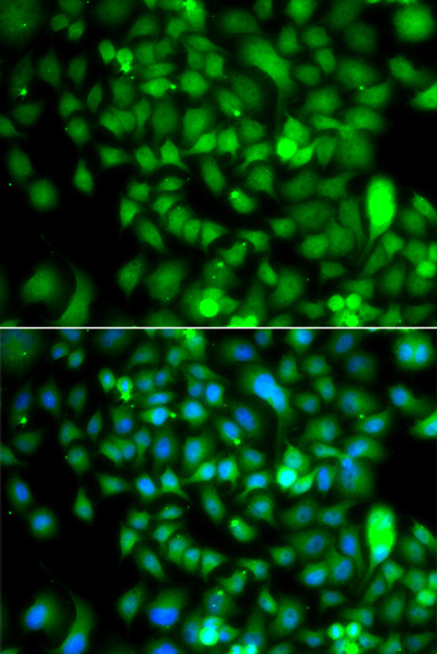 Immunofluorescence analysis of A549 cells using CSRP2BP Polyclonal Antibody