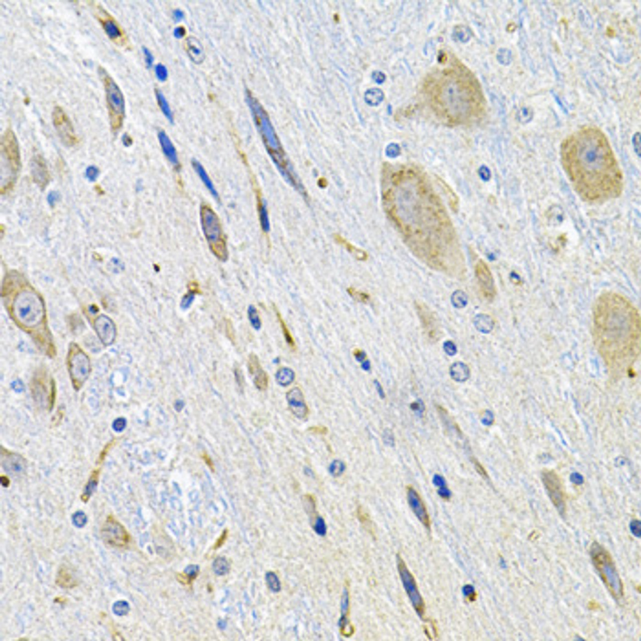 Immunohistochemistry of paraffin-embedded Mouse brain using LGR6 Polyclonal Antibody at dilution of  1:100 (40x lens).