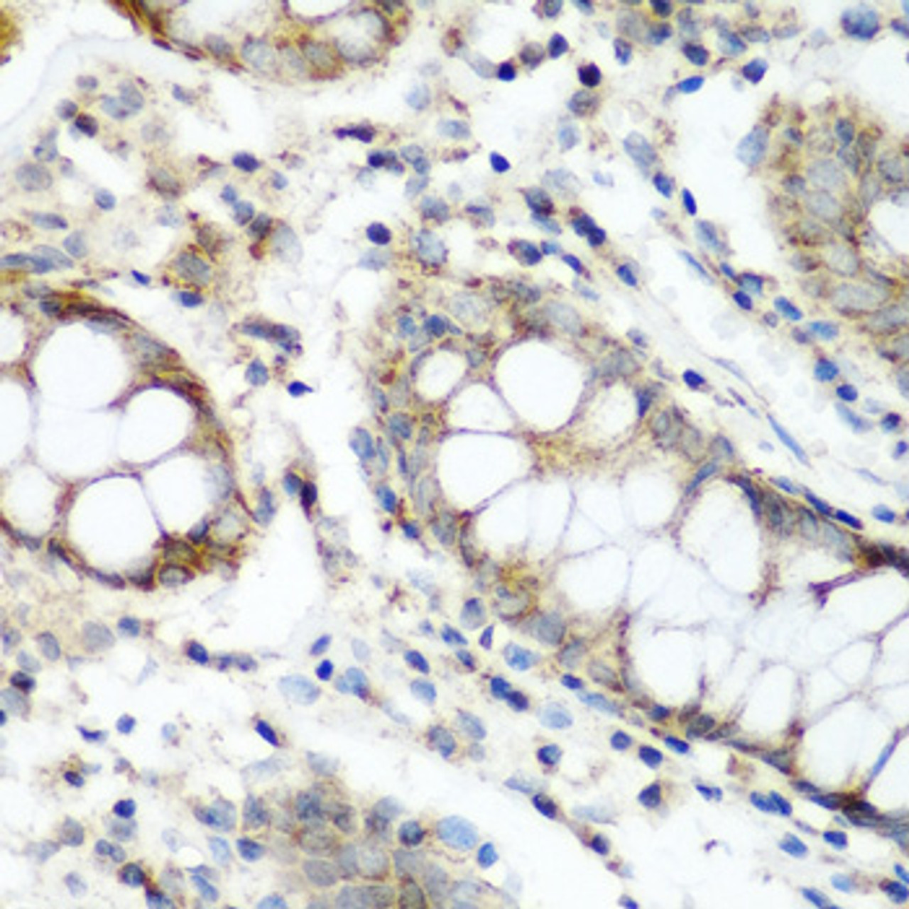 Immunohistochemistry of paraffin-embedded Human colon using NAA60 Polyclonal Antibody at dilution of  1:200 (40x lens).