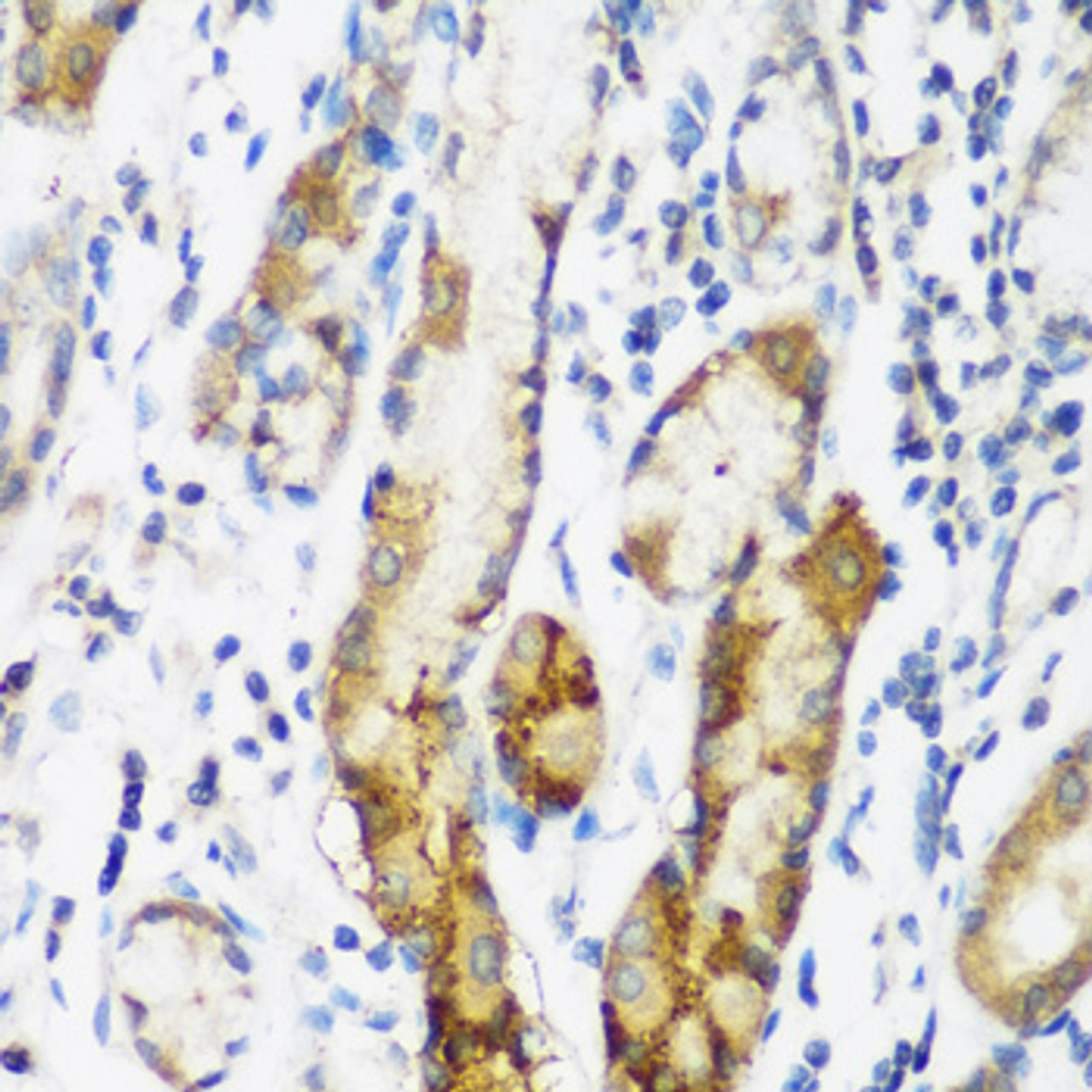 Immunohistochemistry of paraffin-embedded Human gastric using NAA60 Polyclonal Antibody at dilution of  1:200 (40x lens).