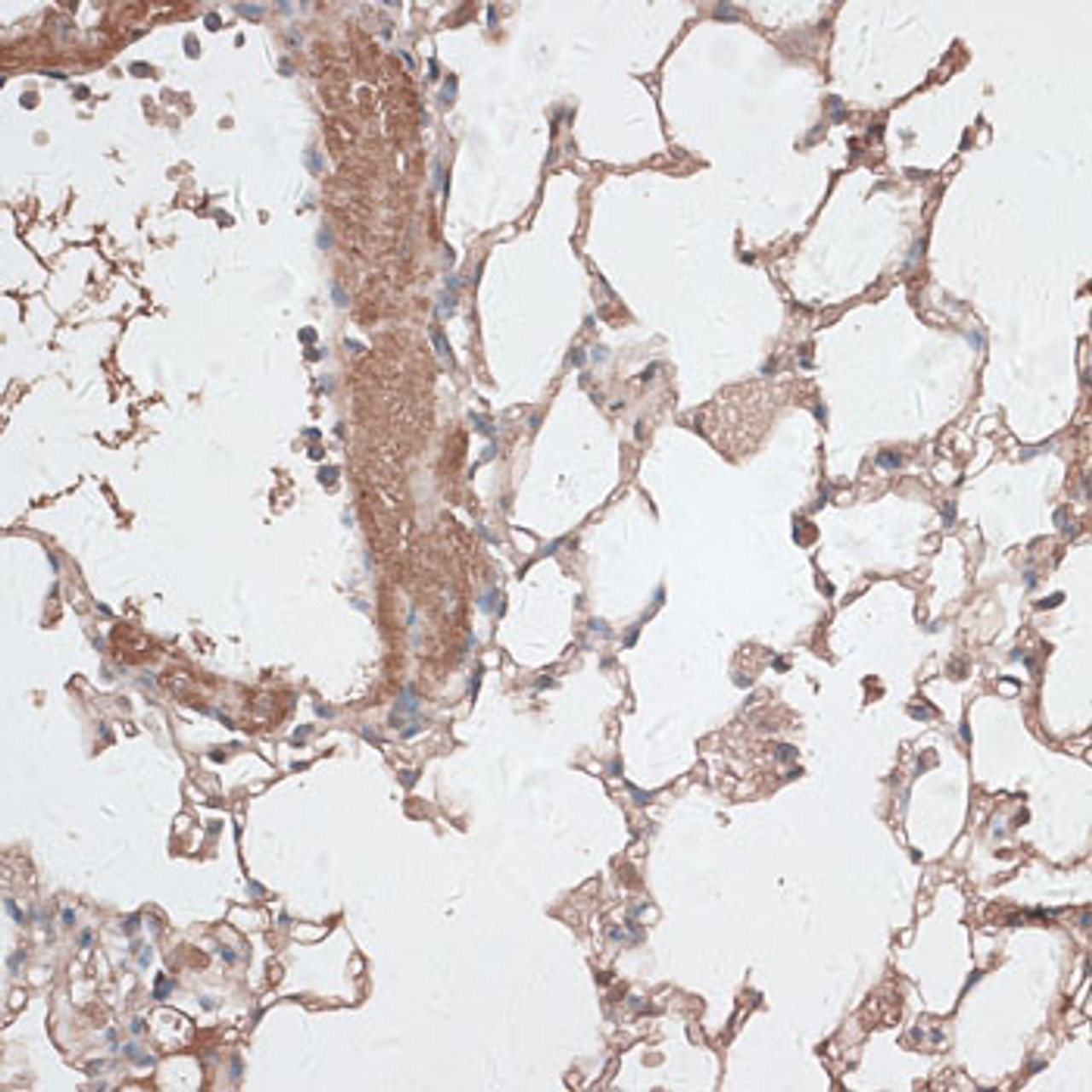 Immunohistochemistry of paraffin-embedded Mouse lung using JMJD7 Polyclonal Antibody at dilution of  1:100 (40x lens).