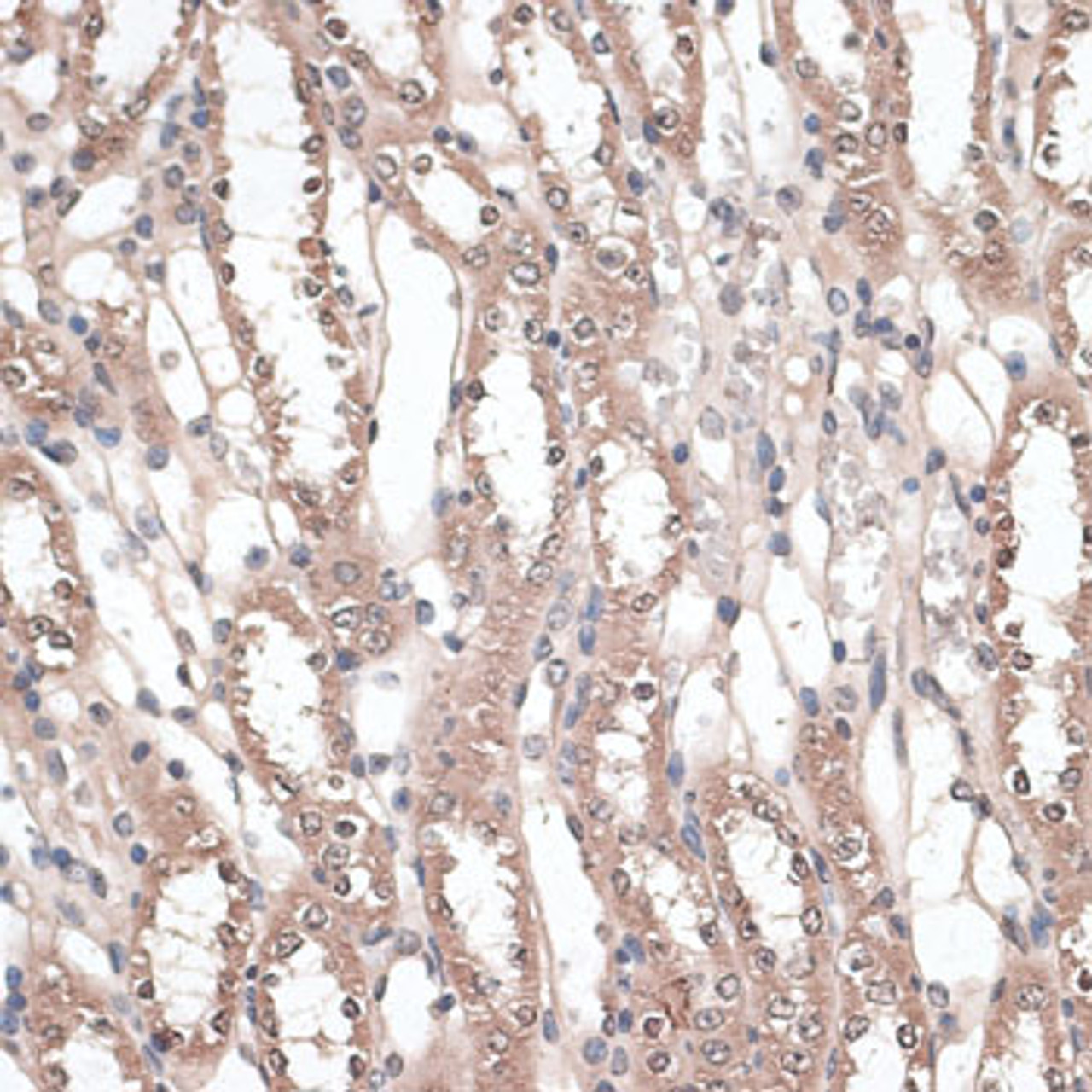 Immunohistochemistry of paraffin-embedded Mouse kidney using JMJD7 Polyclonal Antibody at dilution of  1:100 (40x lens).