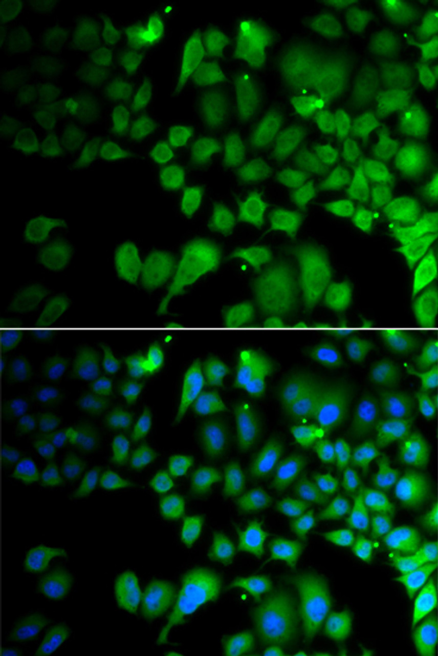 Immunofluorescence analysis of A549 cells using JMJD7 Polyclonal Antibody