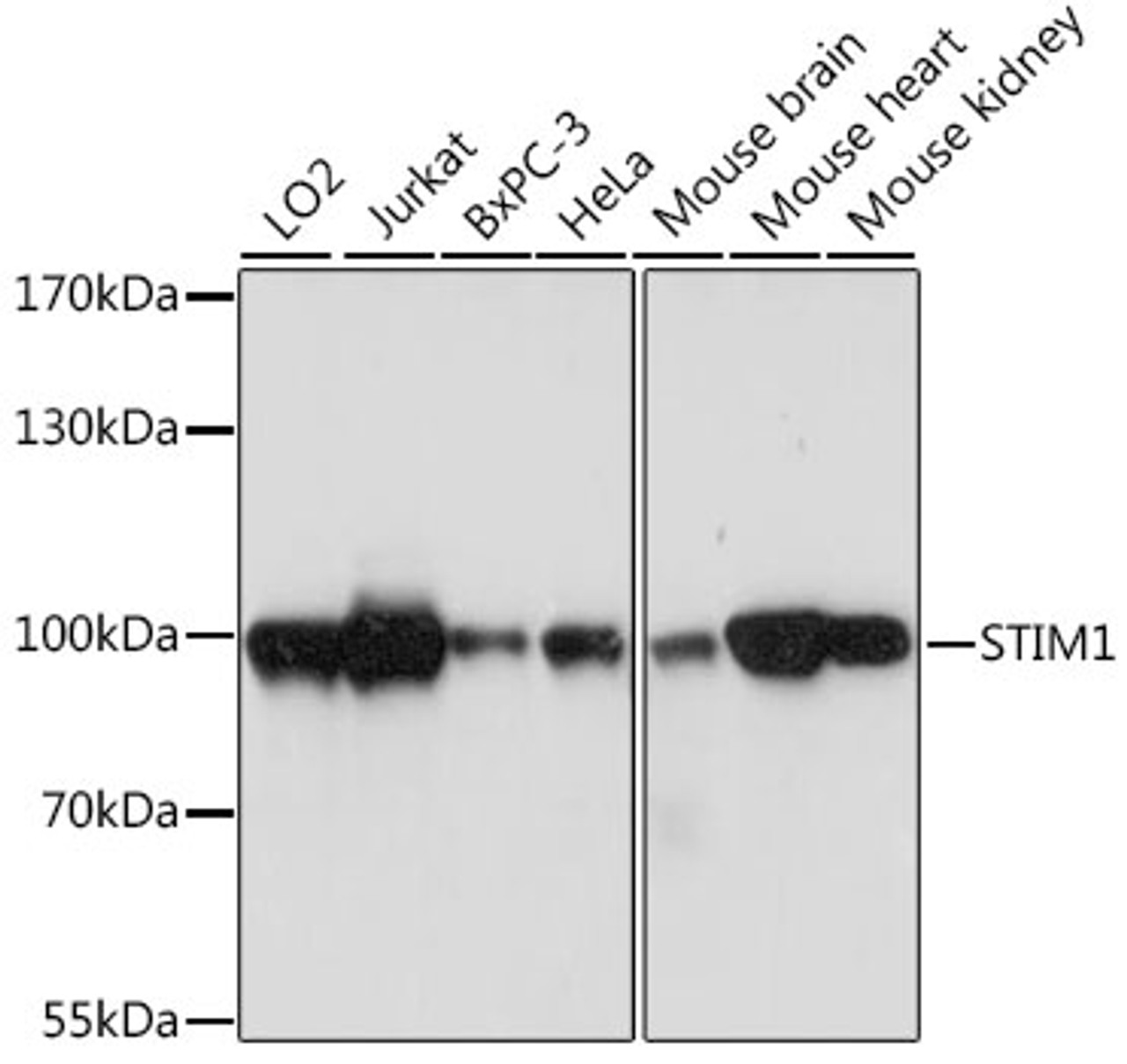 Western blot analysis of extracts of various cell lines using STIM1 Polyclonal Antibody at dilution of 1:1000.