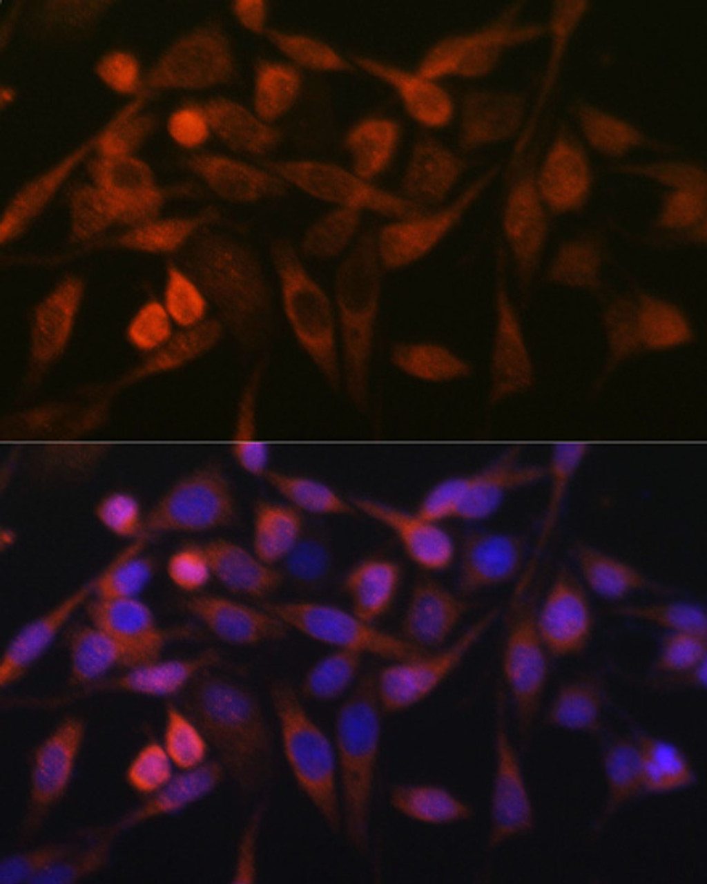 Immunofluorescence analysis of HeLa cells using STIM1 Polyclonal Antibody at dilution of  1:100. Blue: DAPI for nuclear staining.