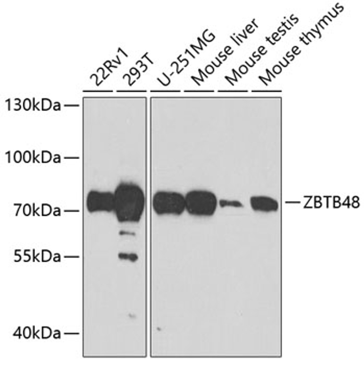 Western blot analysis of extracts of various cell lines using ZBTB48 Polyclonal Antibody at dilution of 1:1000.