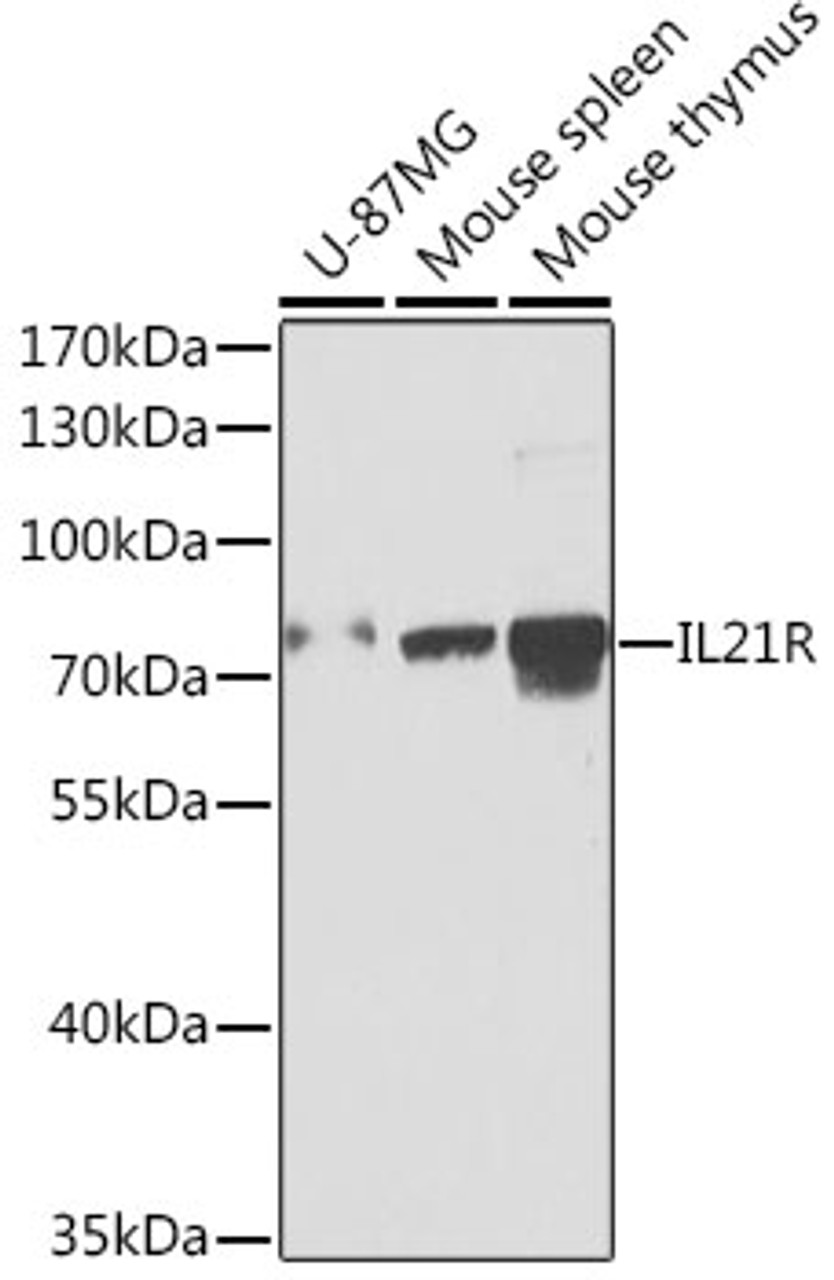 Western blot analysis of extracts of various cell lines using IL21R Polyclonal Antibody at dilution of 1:1000.