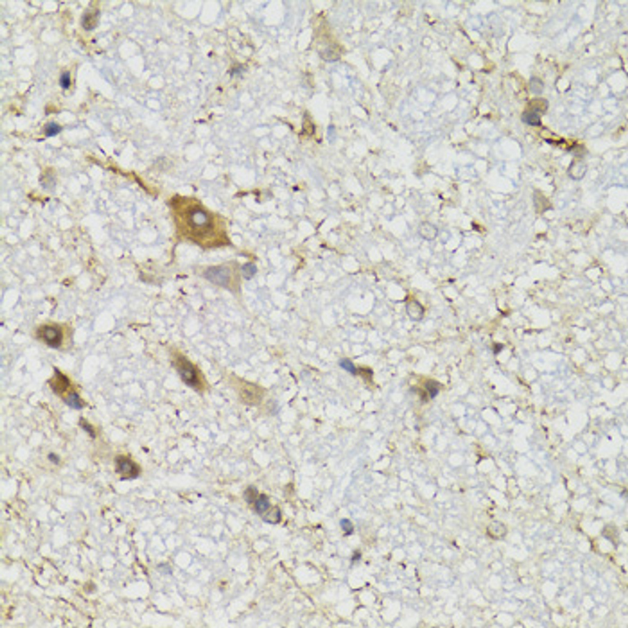 Immunohistochemistry of paraffin-embedded Mouse brain using COQ3 Polyclonal Antibody at dilution of  1:100 (40x lens).