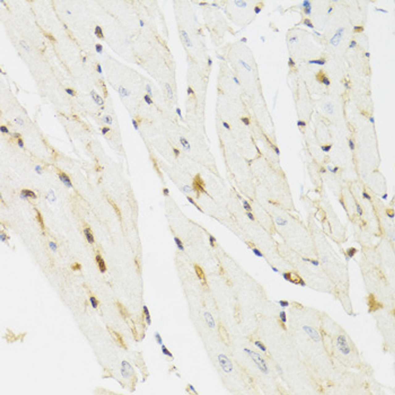 Immunohistochemistry of paraffin-embedded Mouse heart using THAP1 Polyclonal Antibody at dilution of  1:100 (40x lens).