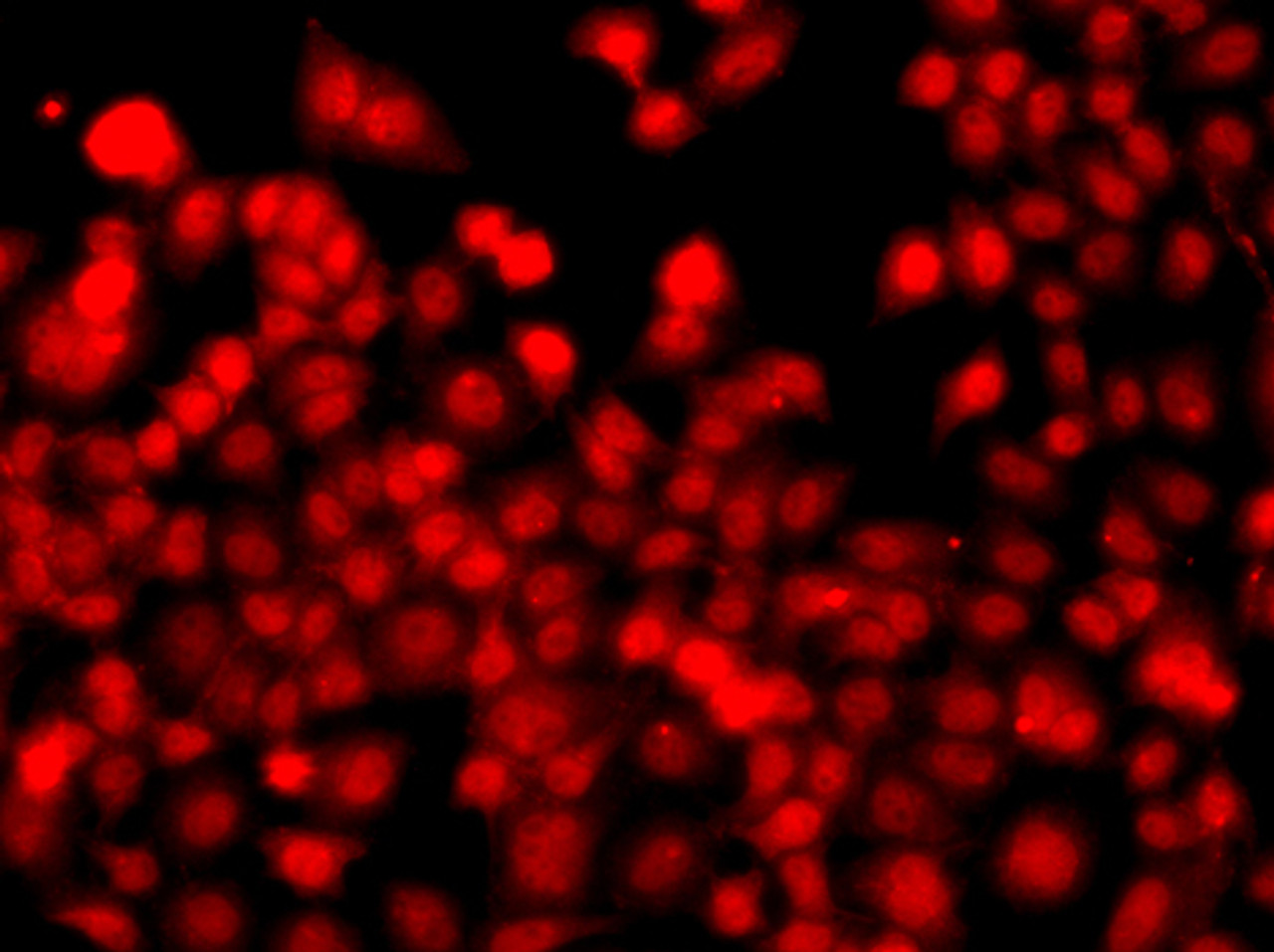 Immunofluorescence analysis of A549 cells using THAP1 Polyclonal Antibody