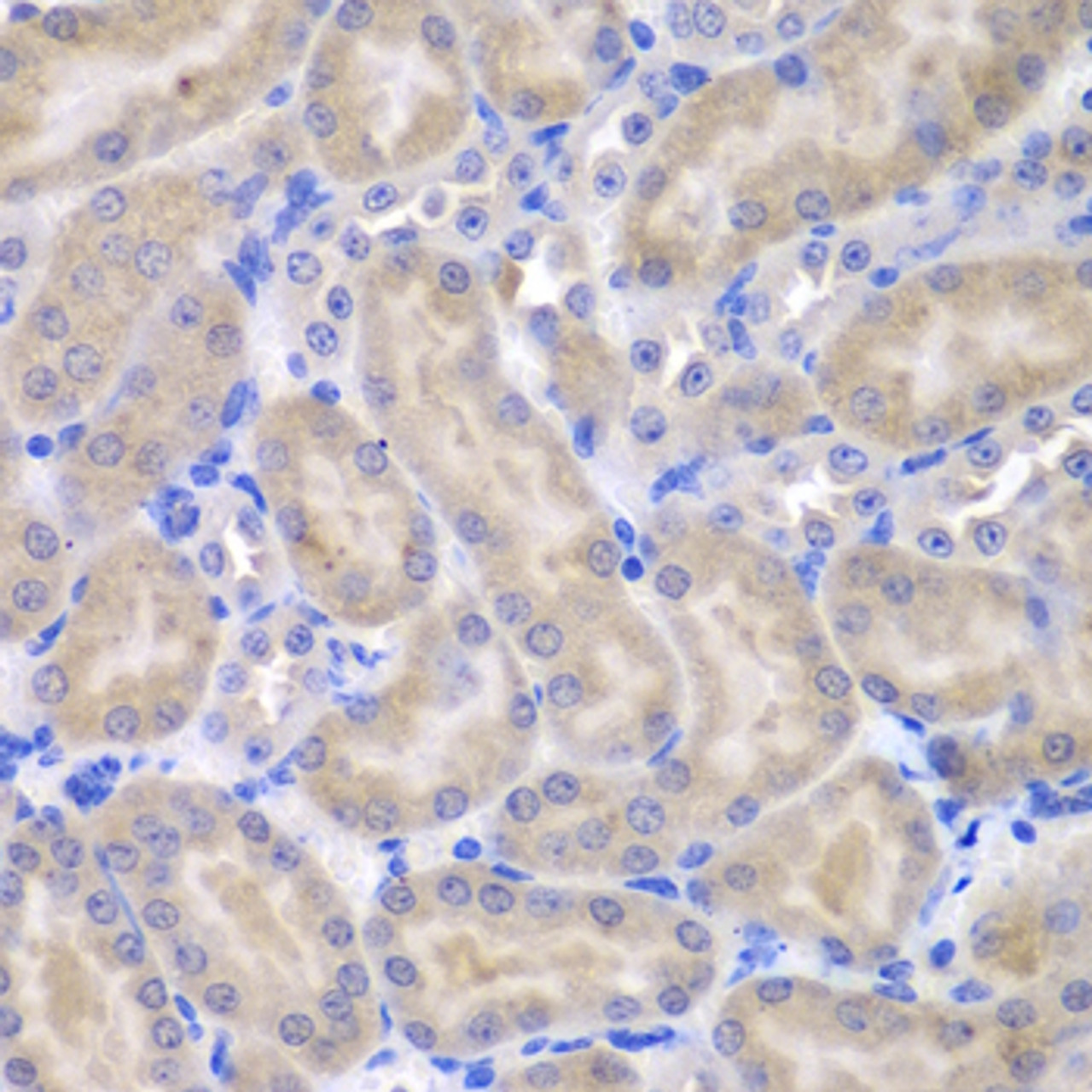 Immunohistochemistry of paraffin-embedded Mouse kidney using ASPSCR1 Polyclonal Antibody at dilution of  1:100 (40x lens).