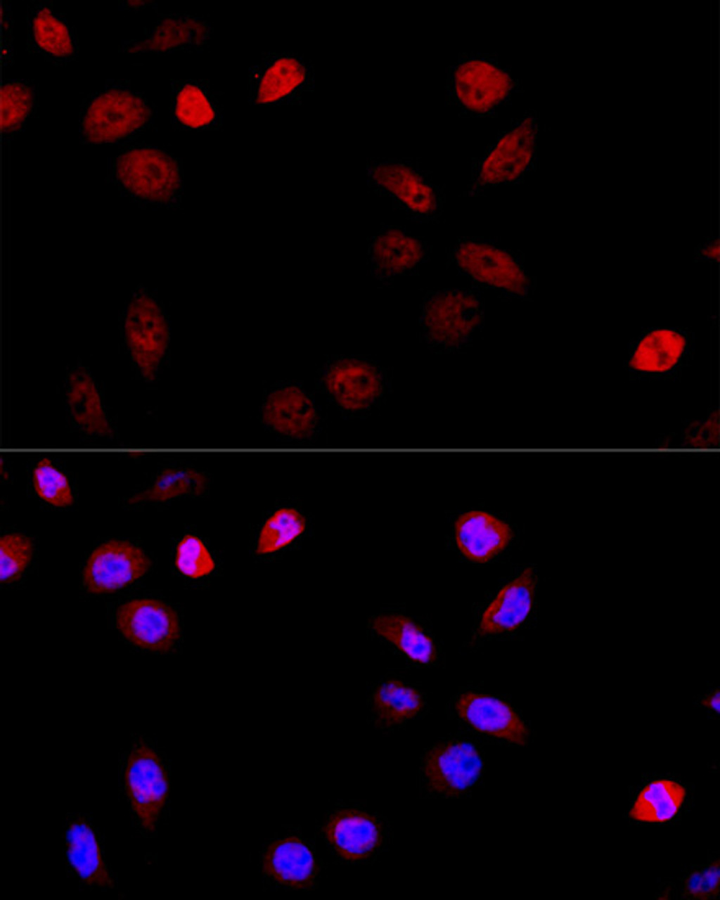 Immunofluorescence analysis of HeLa cells using ASPSCR1 Polyclonal Antibody at dilution of  1:100 (40x lens). Blue: DAPI for nuclear staining.