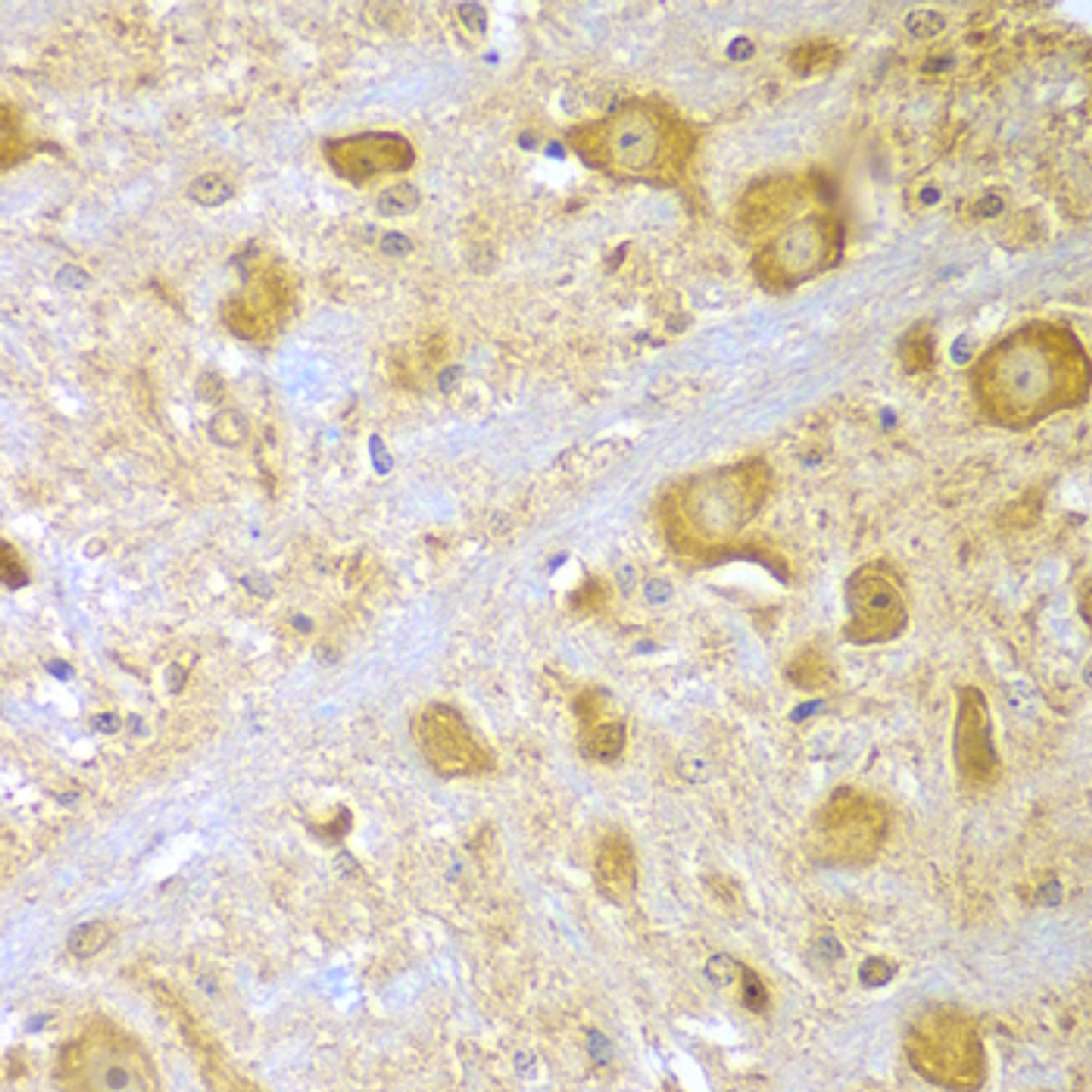 Immunohistochemistry of paraffin-embedded Mouse brain using SPAG16 Polyclonal Antibody at dilution of  1:100 (40x lens).