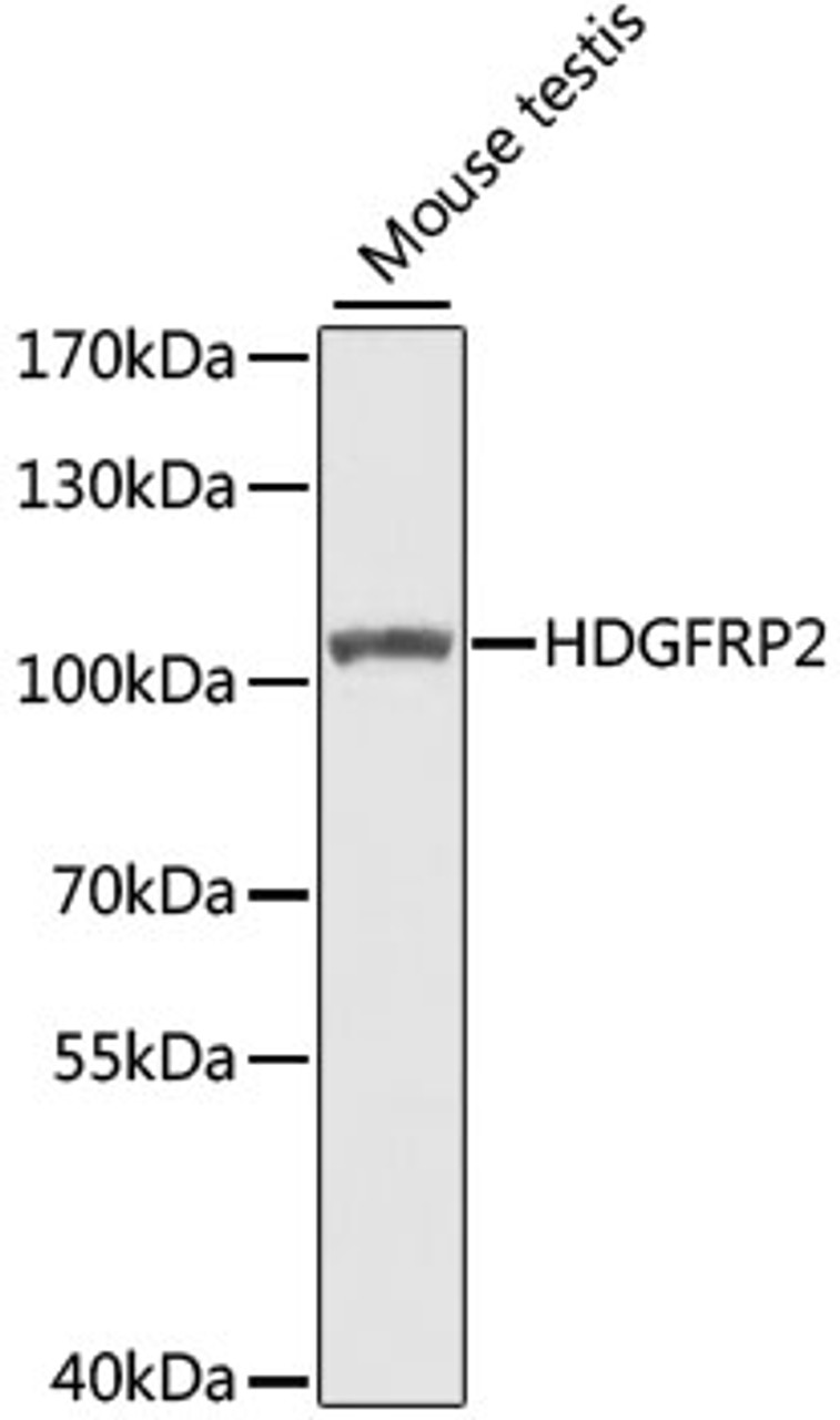 Western blot analysis of extracts of Mouse testis using HDGFRP2 Polyclonal Antibody at dilution of 1:1000.