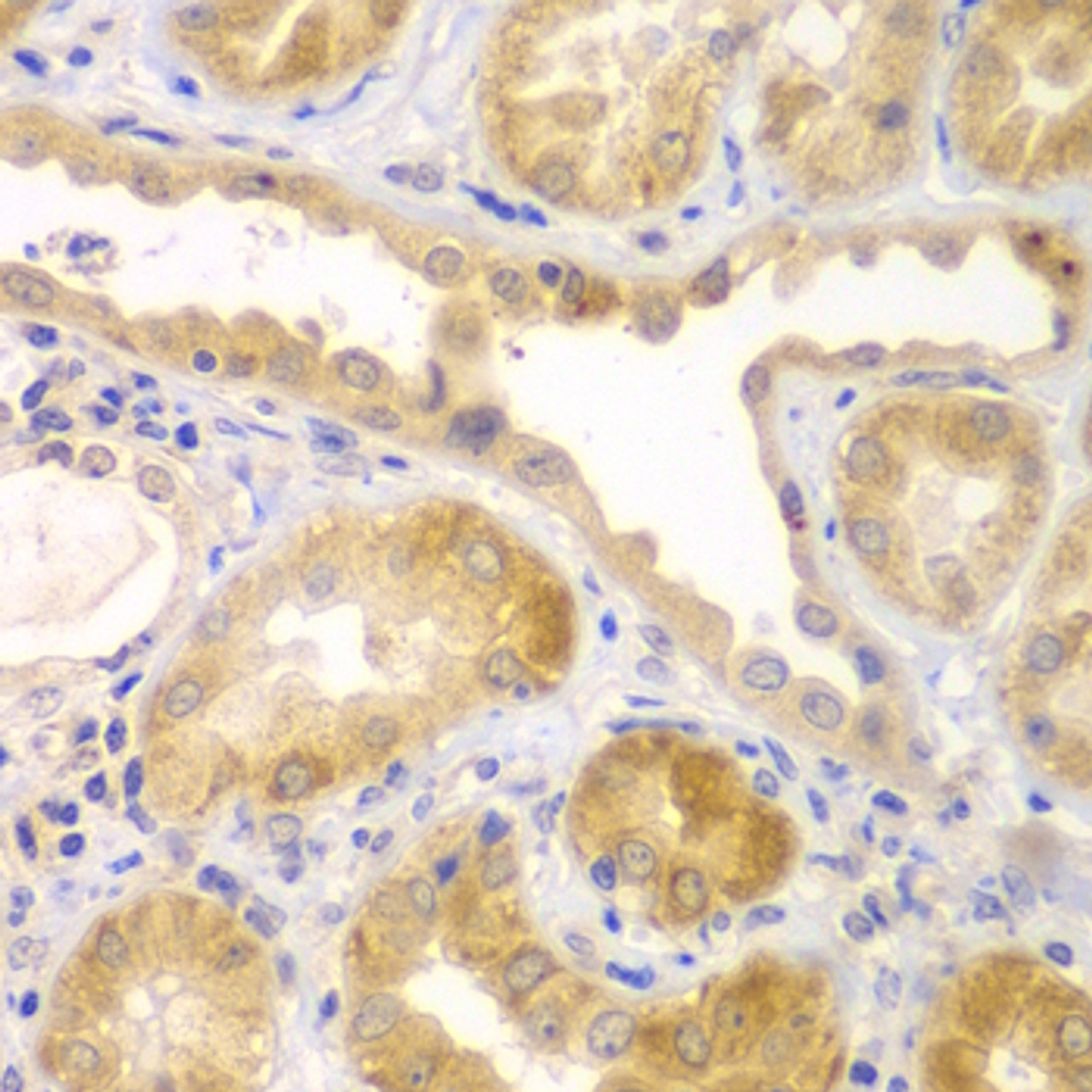 Immunohistochemistry of paraffin-embedded Human kidney using UBA6 Polyclonal Antibody at dilution of  1:100 (40x lens).