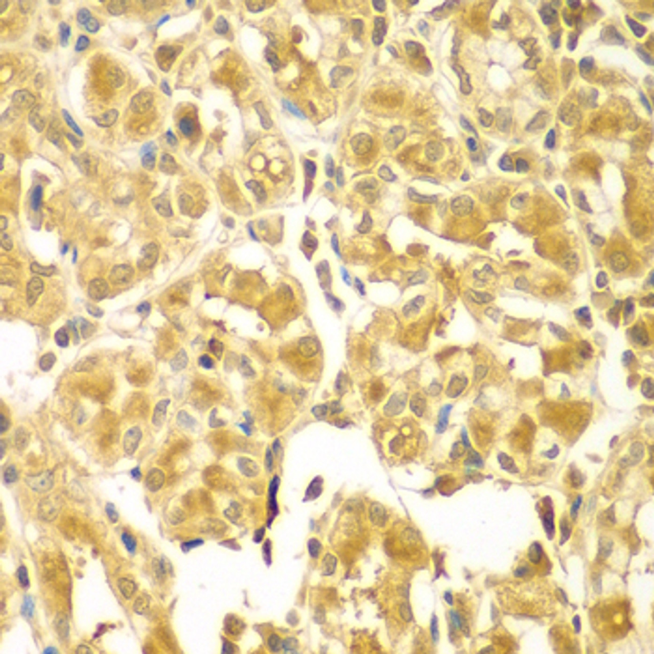 Immunohistochemistry of paraffin-embedded Human gastric using SESN2 Polyclonal Antibody at dilution of  1:100 (40x lens).