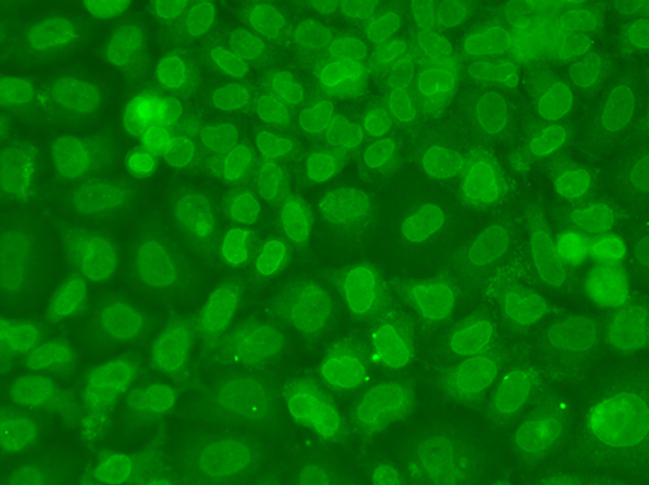 Immunofluorescence analysis of A549 cells using TARBP2 Polyclonal Antibody