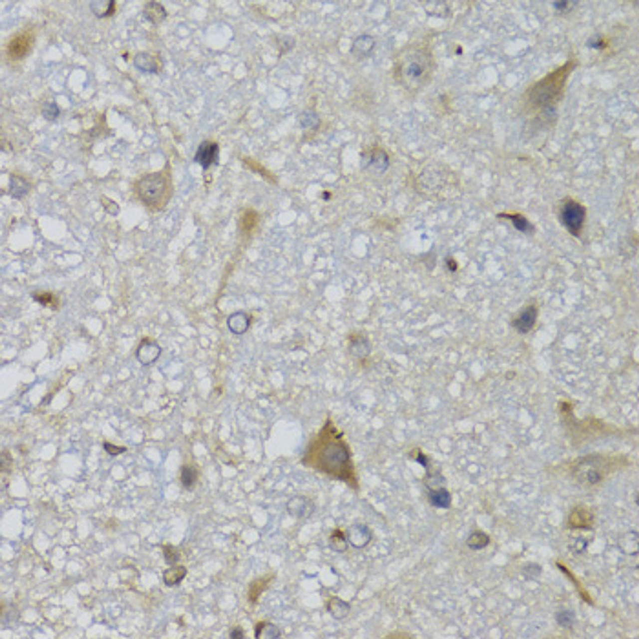 Immunohistochemistry of paraffin-embedded Mouse brain using CHN1 Polyclonal Antibody at dilution of  1:100 (40x lens).