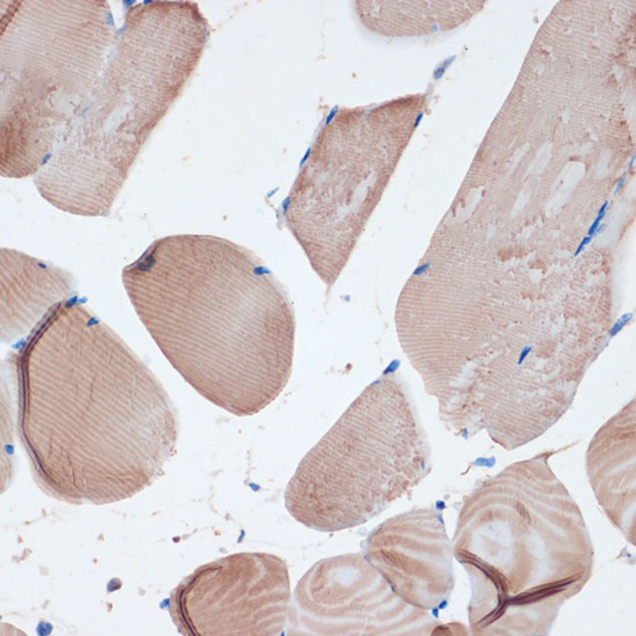 Immunohistochemistry of paraffin-embedded Mouse skeletal muscle using MYH7 Polyclonal Antibody at dilution of  1:100 (40x lens).