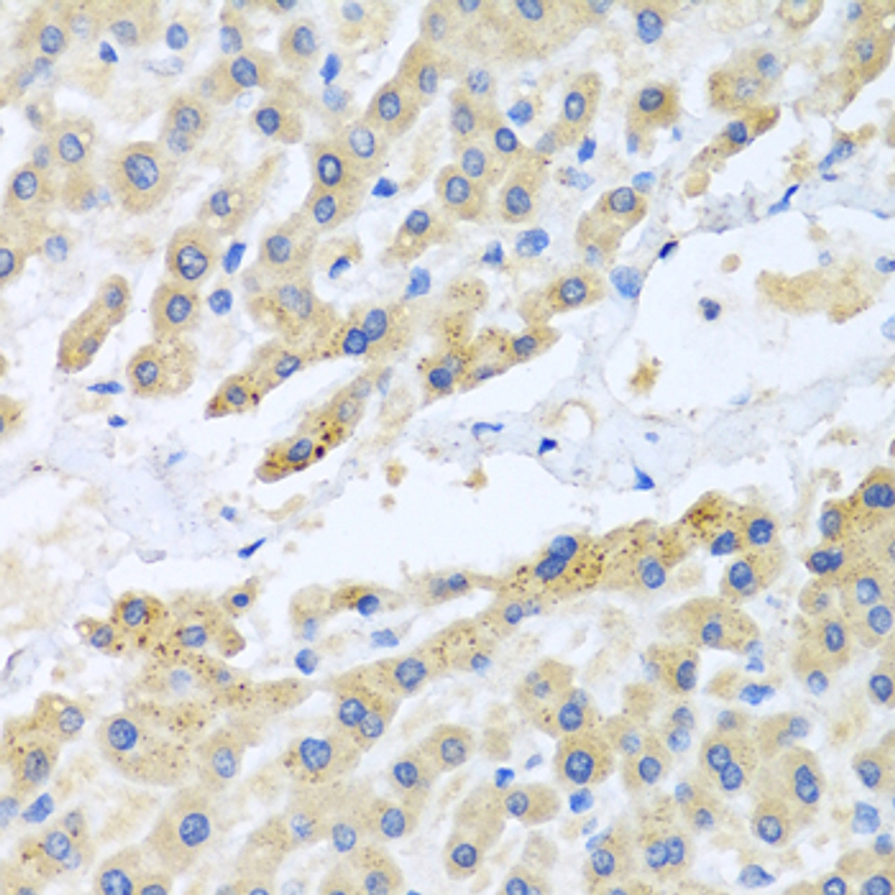 Immunohistochemistry of paraffin-embedded Human liver using CCL3 Polyclonal Antibody at dilution of  1:100 (40x lens).