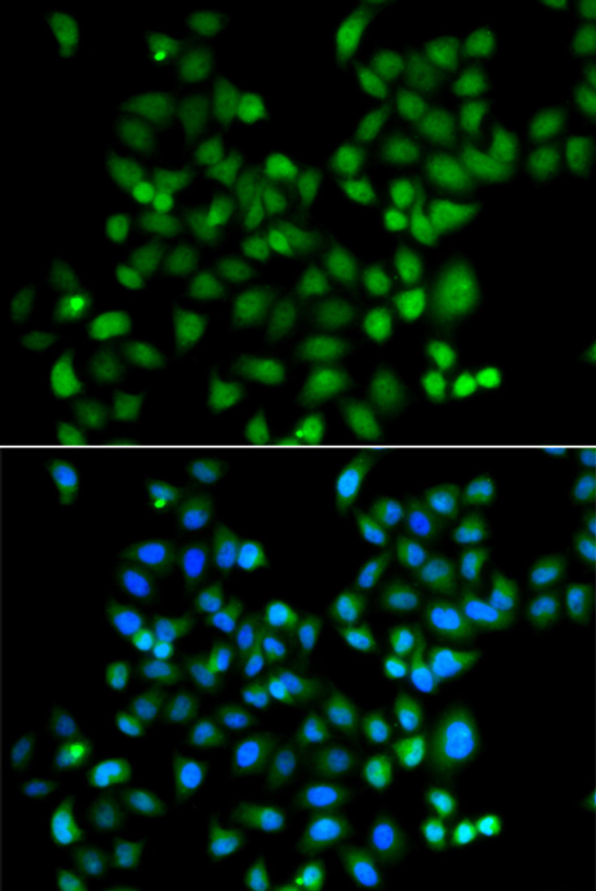 Immunofluorescence analysis of A549 cells using ZSCAN26 Polyclonal Antibody