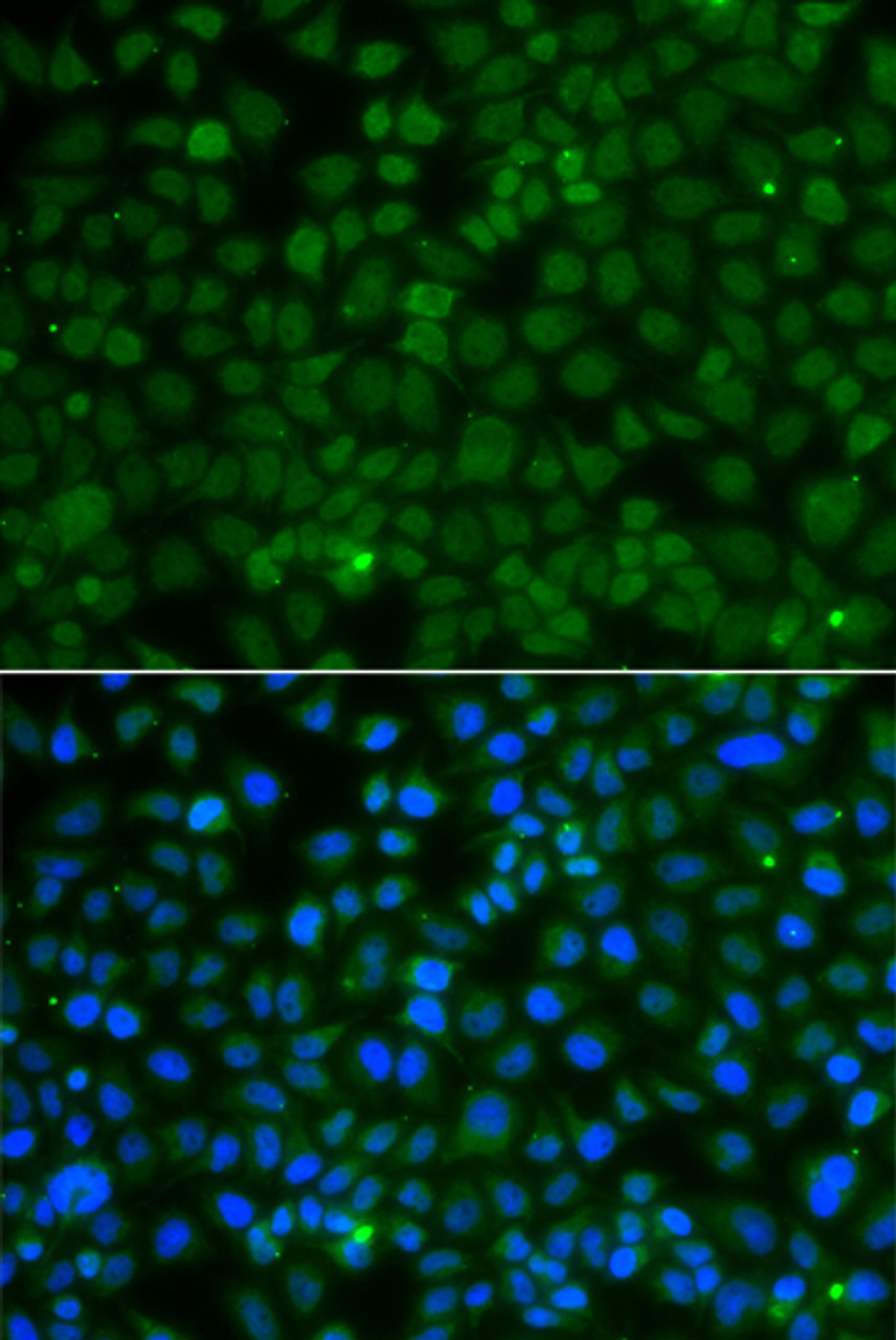 Immunofluorescence analysis of A549 cells using WDR45 Polyclonal Antibody