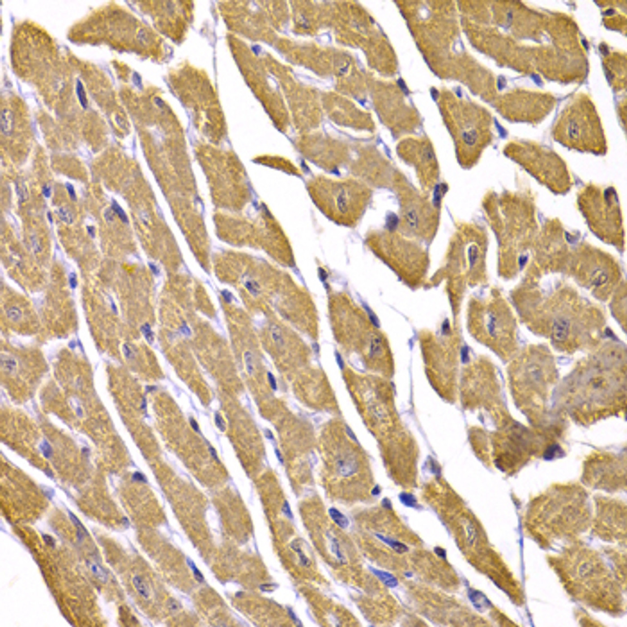 Immunohistochemistry of paraffin-embedded Mouse heart using GLUT4 Polyclonal Antibody at dilution of  1:100 (40x lens).