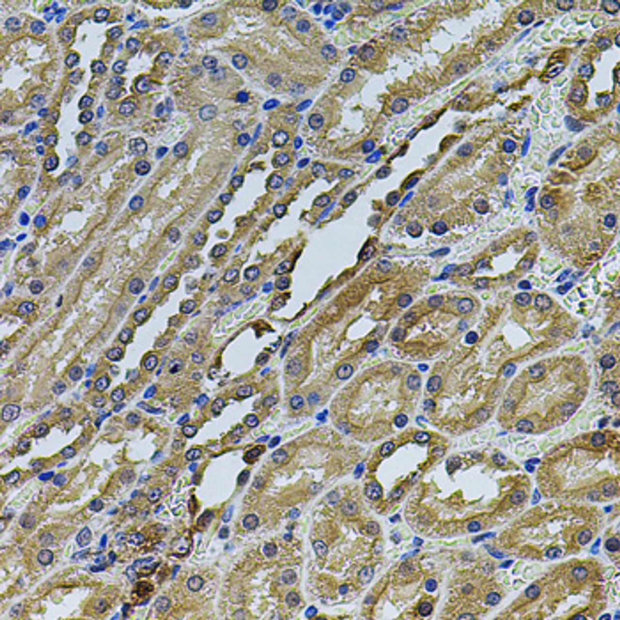 Immunohistochemistry of paraffin-embedded Rat kidney using ANXA8L2 Polyclonal Antibody at dilution of  1:100 (40x lens).