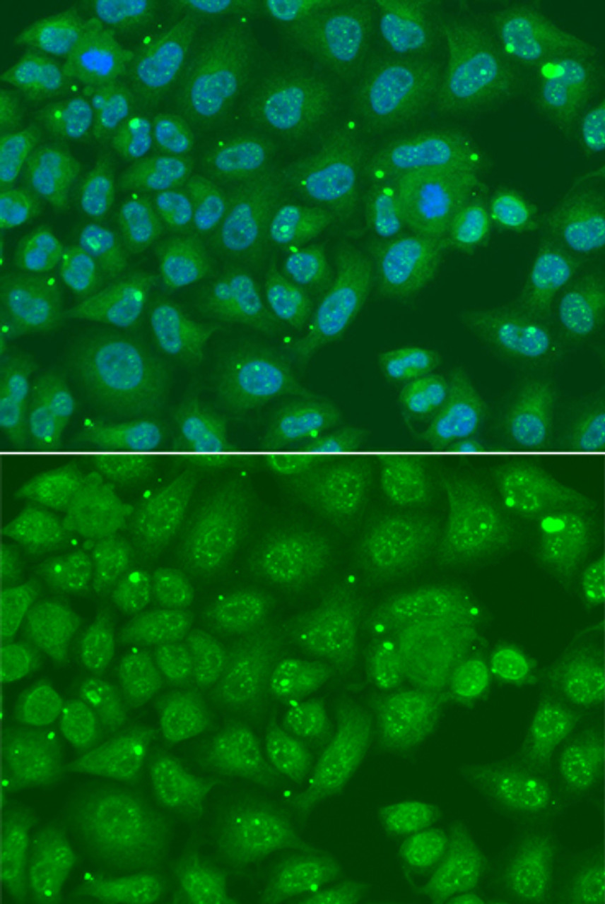 Immunofluorescence analysis of A549 cells using ANXA8L2 Polyclonal Antibody