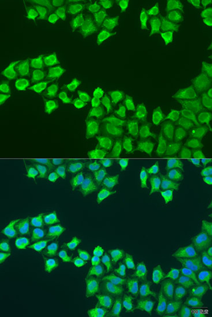 Immunofluorescence analysis of U2OS cells using ATP5F1 Polyclonal Antibody at dilution of  1:100. Blue: DAPI for nuclear staining.