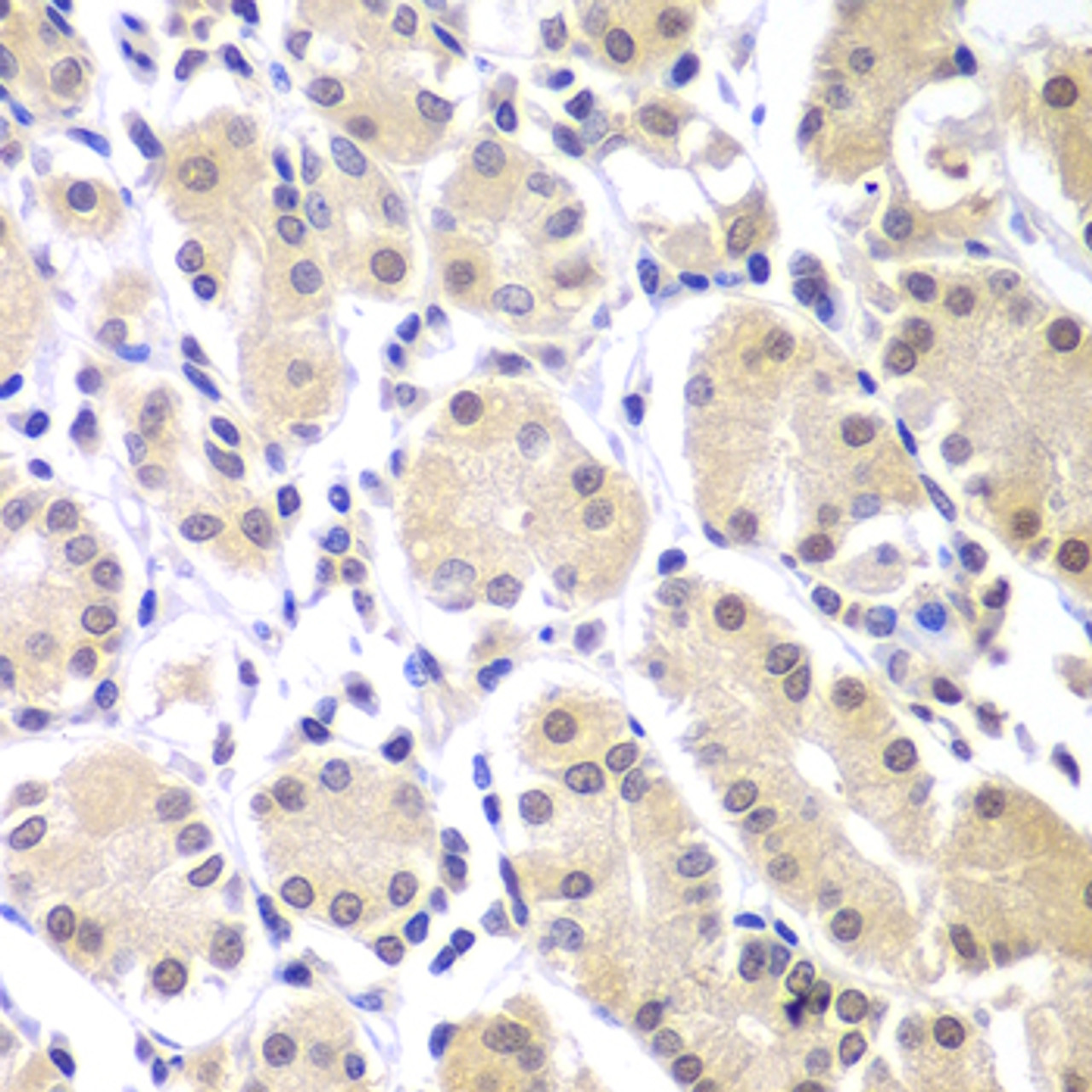 Immunohistochemistry of paraffin-embedded Human gastric using CHEK1 Polyclonal Antibody at dilution of  1:100 (40x lens).
