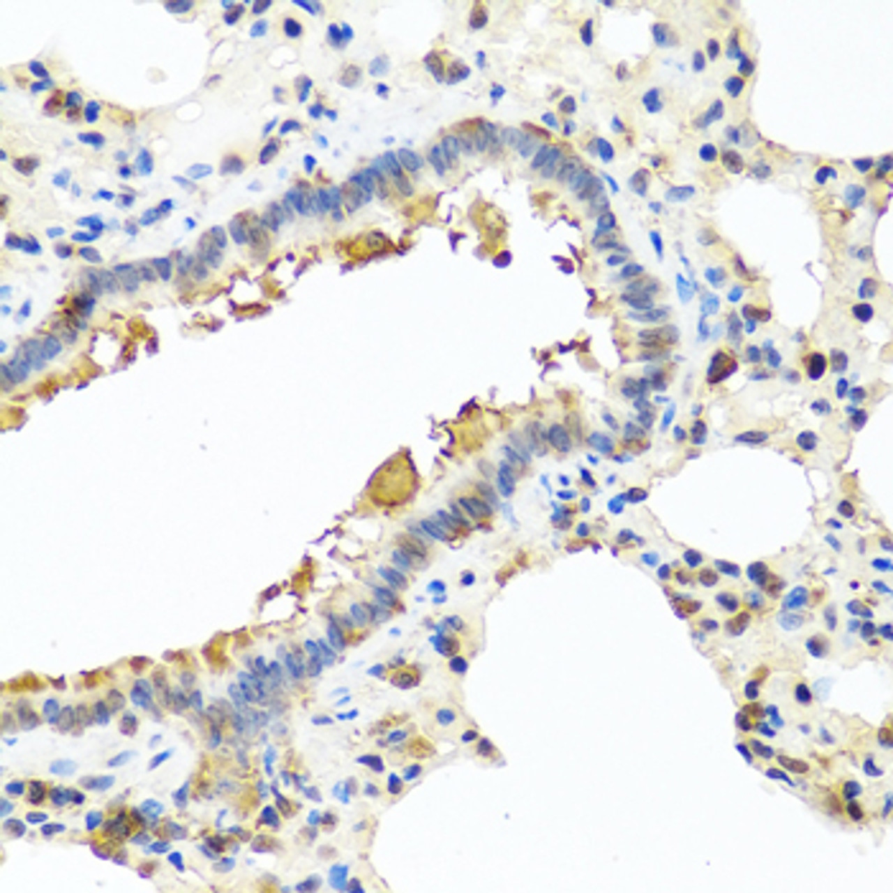 Immunohistochemistry of paraffin-embedded Rat lung using CHI3L2 Polyclonal Antibody at dilution of  1:100 (40x lens).
