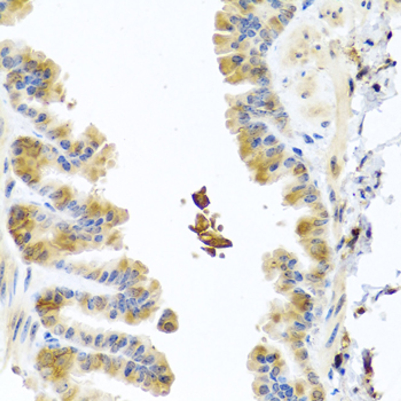 Immunohistochemistry of paraffin-embedded Mouse lung using CHI3L2 Polyclonal Antibody at dilution of  1:100 (40x lens).