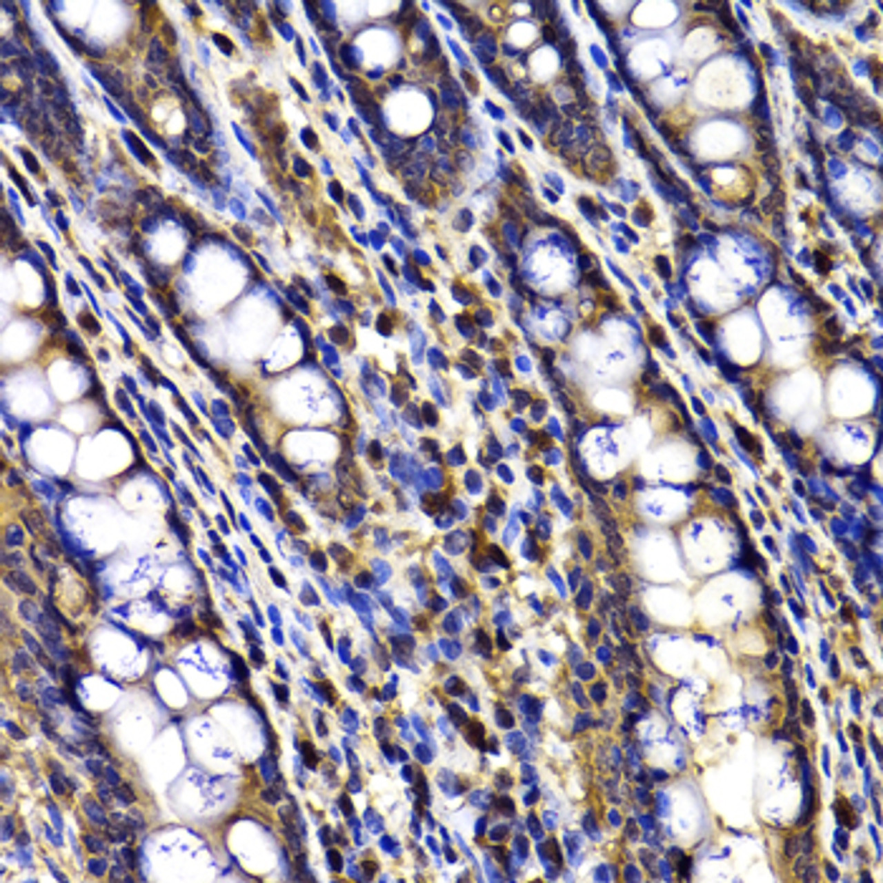 Immunohistochemistry of paraffin-embedded Rat ileum using ARID3A Polyclonal Antibody at dilution of  1:100 (40x lens).
