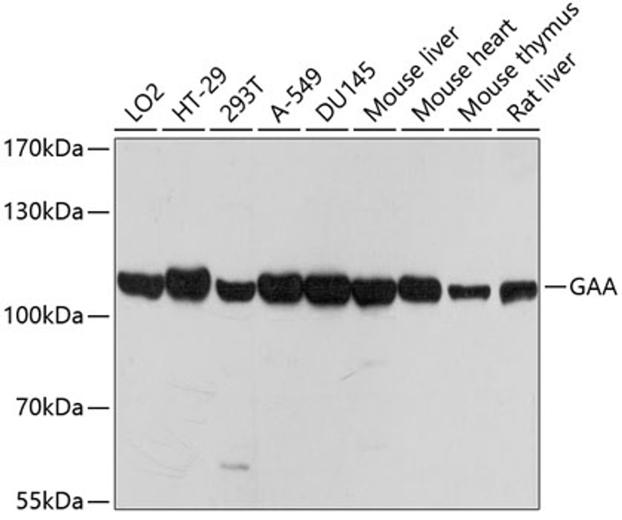 Western blot analysis of extracts of various cell lines using GAA Polyclonal Antibody at dilution of 1:1000.